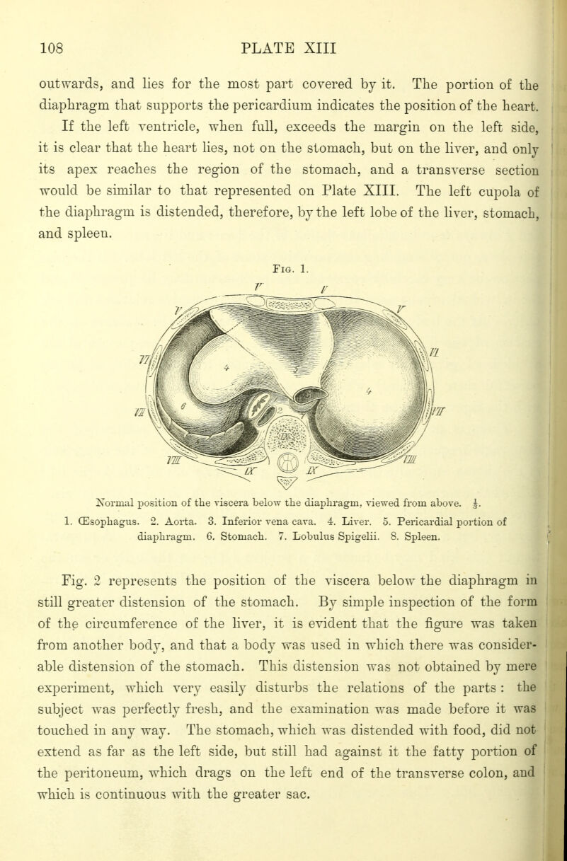 outwards, and lies for the most part covered by it. The portion of the diaphragm that supports the pericardium indicates the position of the heart. If the left ventricle, when full, exceeds the margin on the left side, it is clear that the heart lies, not on the stomach, but on the liver, and only its apex reaches the region of the stomach, and a transverse section would be similar to that represented on Plate XIII. The left cupola of the diaphragm is distended, therefore, by the left lobe of the liver, stomach, and spleen. Fig. 1. Xorinal position of the viscera below tlie diaphragm, viewed from above. J. 1. (Esophagus. 2. Aorta. 3. Inferior vena cava. 4. Liver. 5. Pericardial portion of diaphragm. 6, Stomach. 7. Lobulns Spigelii. 8. Spleen. Fig. 2 represents the position of the viscera below the diaphragm in still greater distension of the stomach. By simple inspection of the form of the circumference of the liver, it is evident that the figure was taken from another body, and that a body was used in which there was consider- able distension of the stomach. This distension was not obtained by mere experiment, which very easily disturbs the relations of the parts : the subject was perfectly fresh, and the examination was made before it was touched in any way. The stomach, which was distended with food, did not extend as far as the left side, but still had against it the fatty portion of the peritoneum, which drags on the left end of the transverse colon, and which is continuous with the greater sac.