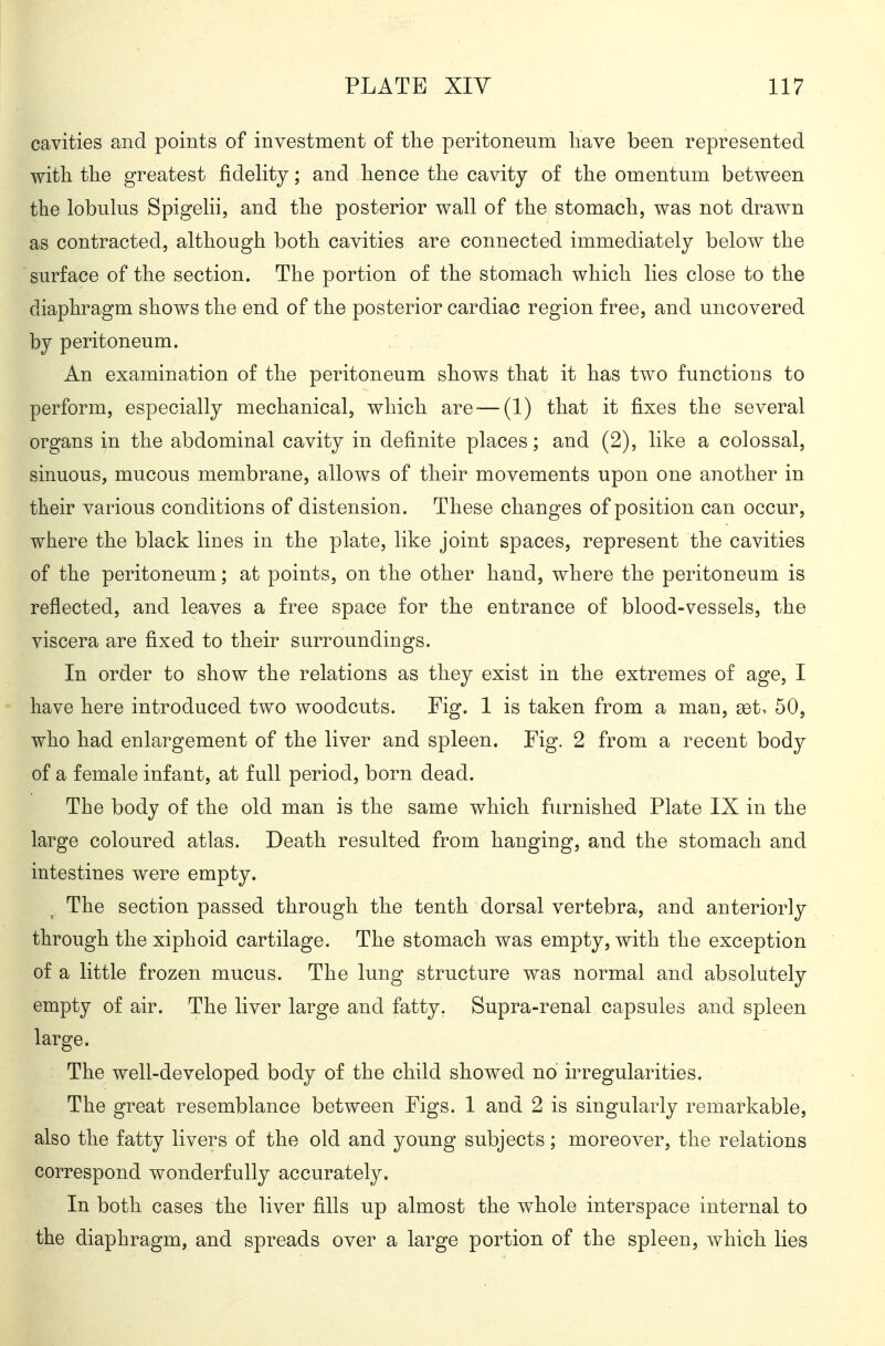cavities and points of investment of the peritoneum liave been represented with the greatest fidelity; and hence the cavity of the omentum between the lobulus SpigeKi, and the posterior wall of the stomach, was not drawn as contracted, although both cavities are connected immediately below the surface of the section. The portion of the stomach which lies close to the diaphragm shows the end of the posterior cardiac region free, and uncovered by peritoneum. An examination of the peritoneum shows that it has two functions to perform, especially mechanical, which are — (1) that it fixes the several organs in the abdominal cavity in definite places; and (2), like a colossal, sinuous, mucous membrane, allows of their movements upon one another in their various conditions of distension. These changes of position can occur, where the black Hues in the plate, like joint spaces, represent the cavities of the peritoneum; at points, on the other hand, where the peritoneum is reflected, and leaves a free space for the entrance of blood-vessels, the viscera are fixed to their surroundings. In order to show the relations as they exist in the extremes of age, I have here introduced two woodcuts. Fig. 1 is taken from a man, set, 50, who had enlargement of the liver and spleen. Fig. 2 from a recent body of a female infant, at full period, born dead. The body of the old man is the same which furnished Plate IX in the large coloured atlas. Death resulted from hanging, and the stomach and intestines were empty. The section passed through the tenth dorsal vertebra, and anteriorly through the xiphoid cartilage. The stomach was empty, with the exception of a little frozen mucus. The lung structure was normal and absolutely empty of air. The liver large and fatty. Supra-renal capsules and spleen large. The well-developed body of the child showed no irregularities. The great resemblance between Figs. 1 and 2 is singularly remarkable, also the fatty livers of the old and young subjects; moreover, the relations correspond wonderfully accurately. In both cases the liver fills up almost the whole interspace internal to the diaphragm, and spreads over a large portion of the spleen, which lies