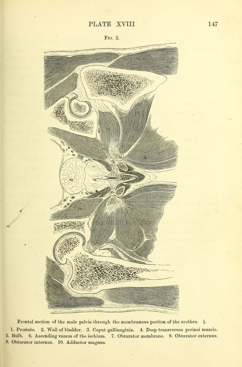 Frontal section of the male pelvis through the membranous portion of the urethra. 4- 1. Prostate. 2. Wall of bladder. 3. Caput gallinaginis. 4. Deep transversus perinei muscle. 5. Bulb. 6, Ascending ramus of the ischium. 7. Obturator membrane. 8. Obturator externus. 9. Obturator internus. 10. Adductor magnus.