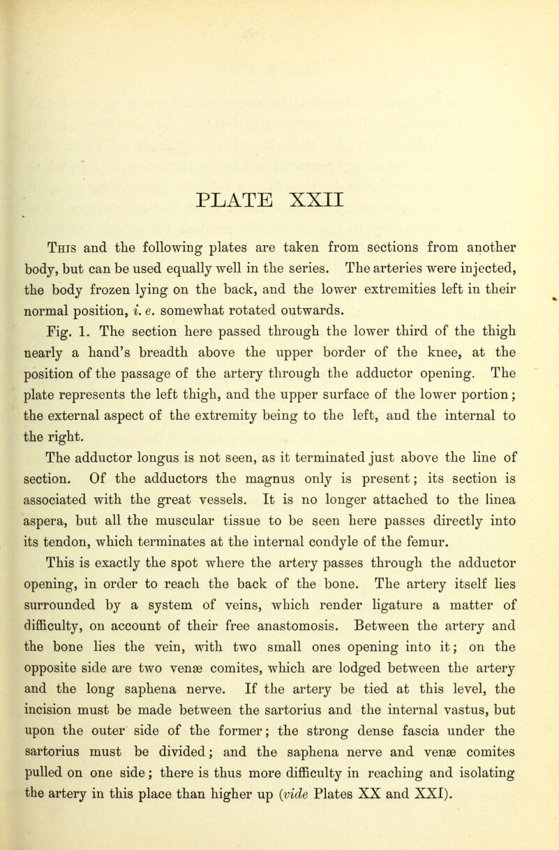 This and tlie following plates are taken from sections from another bodjj but can be used equally well in tlie series. The arteries were injected, the body frozen lying on the back, and the lower extremities left in their normal position, i. e. somewhat rotated outwards. Fig. 1. The section here passed through the lower third of the thigh nearly a hand's breadth above the upper border of the knee, at the position of the passage of the artery through the adductor opening. The plate represents the left thigh, and the upper surface of the lower portion; the external aspect of the extremity being to the left, and the internal to the right. The adductor longus is not seen, as it terminated just above the line of section. Of the adductors the magnus only is present; its section is associated with the great vessels. It is no longer attached to the linea aspera, but all the muscular tissue to be seen here passes directly into its tendon, which terminates at the internal condyle of the femur. This is exactly the spot where the artery passes through the adductor opening, in order to reach the back of the bone. The artery itself lies surrounded by a system of veins, which render ligature a matter of difficulty, on account of their free anastomosis. Between the artery and the bone lies the vein, with two small ones opening into it; on the opposite side are two vense comites, which are lodged between the artery and the long saphena nerve. If the artery be tied at this level, the incision must be made between the sartorius and the internal vastus, but upon the outer side of the former; the strong dense fascia under the sartorius must be divided; and the saphena nerve and vense comites pulled on one side; there is thus more difficulty in reaching and isolating