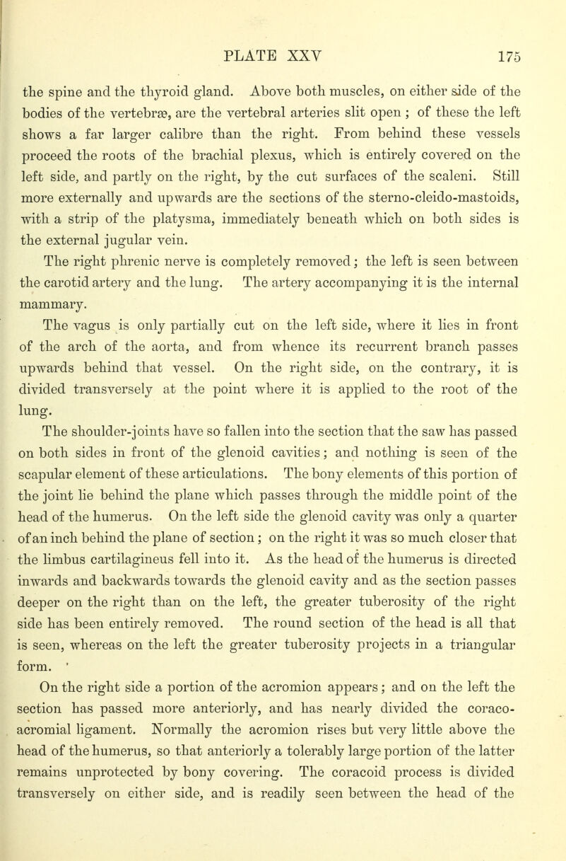 tlie spine and tlie tliyroid gland. Above both muscles, on either side of the bodies of the vertebraa, are the vertebral arteries slit open ; of these the left shows a far larger calibre than the right. From behind these vessels proceed the roots of the brachial plexus, which is entirely covered on the left side, and partly on the right, by the cut surfaces of the scaleni. Still more externally and upwards are the sections of the sterno-cleido-mastoids, with a strip of the platysma, immediately beneath which on both sides is the external jugular vein. The right phrenic nerve is completely removed; the left is seen between the carotid artery and the lung. The artery accompanying it is the internal mammary. The vagus is only partially cut on the left side, where it lies in front of the arch of the aorta, and from whence its recurrent branch passes upwards behind that vessel. On the right side, on the contrary, it is divided transversely at the point where it is applied to the root of the lung. The shoulder-joints have so fallen into the section that the saw has passed on both sides in front of the glenoid cavities; and nothing is seen of the scapular element of these articulations. The bony elements of this portion of the joint lie behind the plane which passes through the middle point of the head of the humerus. On the left side the glenoid cavity was only a quarter of an inch behind the plane of section; on the right it was so much closer that the limbus cartilagineus fell into it. As the head of the humerus is directed inwards and backwards towards the glenoid cavity and as the section passes deeper on the right than on the left, the greater tuberosity of the right side has been entirely removed. The round section of the head is all that is seen, whereas on the left the greater tuberosity projects in a triangular form. ' On the right side a portion of the acromion appears; and on the left the section has passed more anteriorly, and has nearly divided the coraco- acromial ligament. Normally the acromion rises but very little above the head of the humerus, so that anteriorly a tolerably large portion of the latter remains unprotected by bony covering. The coracoid process is divided transversely on either side^ and is readily seen between the head of the