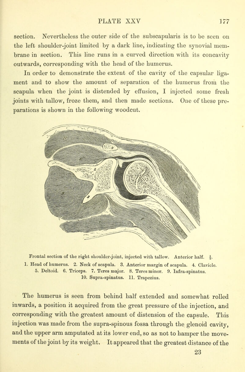 section. Nevertheless the outer side of the subscapularis is to be seen on the left shoulder-joint limited by a dark line, indicating the synovial mem- brane in section. This line runs in a curved direction with its concavity outwards, corresponding with the head of the humerus. In order to demonstrate the extent of the cavity of the capsular liga- ment and to show the amount of separation of the humerus from the scapula when the joint is distended by effusion, I injected some fresh joints with tallow, froze them, and then made sections. One of these pre- parations is shown in the following woodcut. Frontal section of the riglit slaoulder-joint, injected with tallow. Anterior half. 4. 1. Head of humerus. 2. Neck of scapula. 3. Anterior margin of scapula. 4. Clavicle. 5. Deltoid. 6. Triceps. 7. Teres major. 8. Teres minor. 9. Infra-spinatus. 10. Supra-spinatus. 11. Trapezius. The humerus is seen from behind half extended and somewhat rolled inwards, a position it acquired from the great pressure of the injection, and corresponding with the greatest amount of distension of the capsule. This injection was made from the supra-spinous fossa through the glenoid cavity, and the upper arm amputated at its lower end, so as not to hamper the move- ments of the joint by its weight. It appeared that the greatest distance of the 23