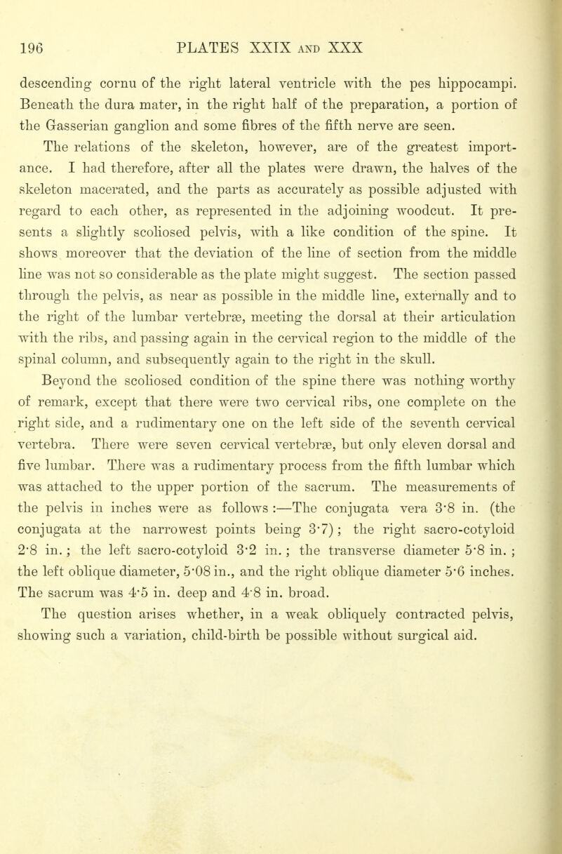 descending cornu of the right lateral ventricle with the pes hippocampi. Beneath the dura mater, in the right half of the preparation, a portion of the Gasserian ganglion and some fibres of the fifth nerve are seen. The relations of the skeleton, however, are of the greatest import- ance. I had therefore, after all the plates were drawn, the halves of the skeleton macerated, and the parts as accurately as possible adjusted with regard to each other, as represented in the adjoining woodcut. It pre- sents a shghtly scoliosed pelvis, with a like condition of the spine. It shows moreover that the deviation of the line of section from the middle line was not so considerable as the plate might suggest. The section passed through the pelvis, as near as possible in the middle line, externally and to the right of the lumbar vertebrae, meeting the dorsal at their articulation with the ribs, and passing again in the cervical region to the middle of the spinal column, and subsequently again to the right in the skull. Beyond the scoliosed condition of the spine there was nothing worthy of remark, except that there were two cervical ribs, one complete on the right side, and a rudimentary one on the left side of the seventh cervical vertebra. There were seven cervical vertebras, but only eleven dorsal and five lumbar. There was a rudimentary process from the fifth lumbar which was attached to the upper portion of the sacrum. The measurements of the pelvis in inches were as follows :—The conjugata vera 3*8 in. (the conjugata at the narrowest points being 3'7); the right sacro-cotyloid 2'8 in.; the left sacro-cotyloid 3*2 in.; the transverse diameter 5*8 in. ; the left oblique diameter, 5'08 in., and the right oblique diameter 56 inches. The sacrum was 4*5 in. deep and 4*8 in. broad. The question arises whether, in a weak obliquely contracted pelvis, showing such a variation, child-birth be possible without surgical aid.