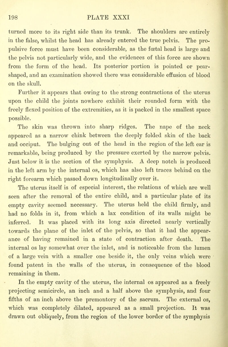 turned more to its right side than its trunk. The shoulders are entirely in the false, whilst the head has already entered the true pelvis. The pro- pulsive force must have been considerable, as the foetal head is large and the pelvis not particularly wide, and the evidences of this force are shown from the form of the head. Its posterior portion is pointed or pear- shaped, and an examination showed there was considerable effusion of blood on the skull. Further it appears that owing to the strong contractions of the uterus upon the child the joints nowhere exhibit their rounded form with the freely flexed position of the extremities, as it is packed in the smallest space possible. The skin was thrown into sharp ridges. The nape of the neck appeared as a narrow chink between the deeply folded skin of the back and occiput. The bulging out of the head in the region of the left ear is remarkable, being produced by the pressure exerted by the narrow pelvis. Just below it is the section of the symphysis. A deep notch is produced in the left arm by the internal os, which has also left traces behind on the right forearm which passed down longitudinally over it. The uterus itself is of especial interest, the relations of which are well seen after the removal of the entire child, and a particular plate of its empty cavity seemed necessary. The uterus held the child firmly, and had no folds in it, from which a lax condition of its walls might be inferred. It was placed with its long axis directed nearly vertically towards the plane of the inlet of the pelvis, so that it had the appear- ance of having remained in a state of contraction after death. The internal os lay somewhat over the inlet, and is noticeable from the lumen of a large vein with a smaller one beside it, the only veins which were found patent in the walls of the uterus, in consequence of the blood remaining in them. In the empty cavity of the uterus, the internal os appeared as a freely projecting semicircle, an inch and a half above the symphysis, and four fifths of an inch above the promontory of the sacrum. The external os, which was completely dilated, appeared as a small projection. It was drawn out obliquely, from the region of the lower border of the symphysis