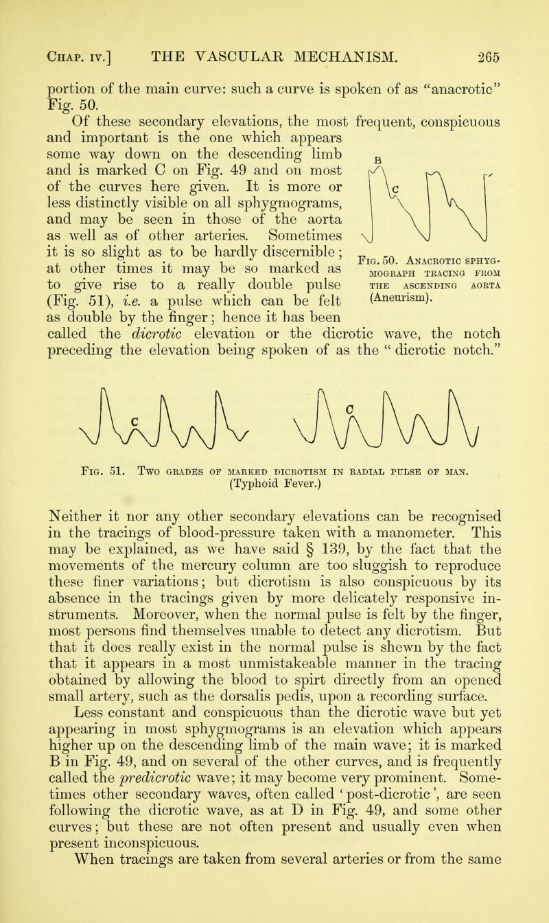 portion of the main curve: such a curve is spoken of as anacrotic Fig. 50. Of these secondary elevations, the most frequent, conspicuous and important is the one which appears some Avay down on the descending limb and is marked C on Fig. 49 and on most of the curves here given. It is more or less distinctly visible on all sphygmograms, and may be seen in those of the aorta as well as of other arteries. Sometimes it is so slight as to be hardly discernible; at other times it may be so marked as to give rise to a really double pulse (Fig. 51), i.e. a pulse which can be felt as double by the finger; hence it has been called the dicrotic elevation or the dicrotic wave, the notch preceding the elevation being spoken of as the  dicrotic notch. Fig. 50. Anaceotic sphyg- mograph tracing from the ascending aorta (Aneurism). Fig. 51. Two GRADES OF MARKED DICROTISM IN RADIAL PULSE OF MAN. (Typhoid Fever.) Neither it nor any other secondary elevations can be recognised in the tracings of blood-pressure taken with a manometer. This may be explained, as we have said § 139, by the fact that the movements of the mercury column are too sluggish to reproduce these finer variations; but dicrotism is also conspicuous by its absence in the tracings given by more delicately responsive in- struments. Moreover, when the normal pulse is felt by the finger, most persons find themselves unable to detect any dicrotism. But that it does really exist in the normal pulse is shewn by the fact that it appears in a most unmistakeable manner in the tracing obtained by allowing the blood to spirt directly from an opened small artery, such as the dorsalis pedis, upon a recording surface. Less constant and conspicuous than the dicrotic wave but yet appearing in most sphygmograms is an elevation which appears higher up on the descending limb of the main wave; it is marked B in Fig. 49, and on several of the other curves, and is frequently called the predicrotic wave; it may become very prominent. Some- times other secondary waves, often called ' post-dicrotic', are seen following the dicrotic wave, as at D in Fig. 49, and some other curves; but these are not often present and usually even when present inconspicuous. When tracings are taken from several arteries or from the same