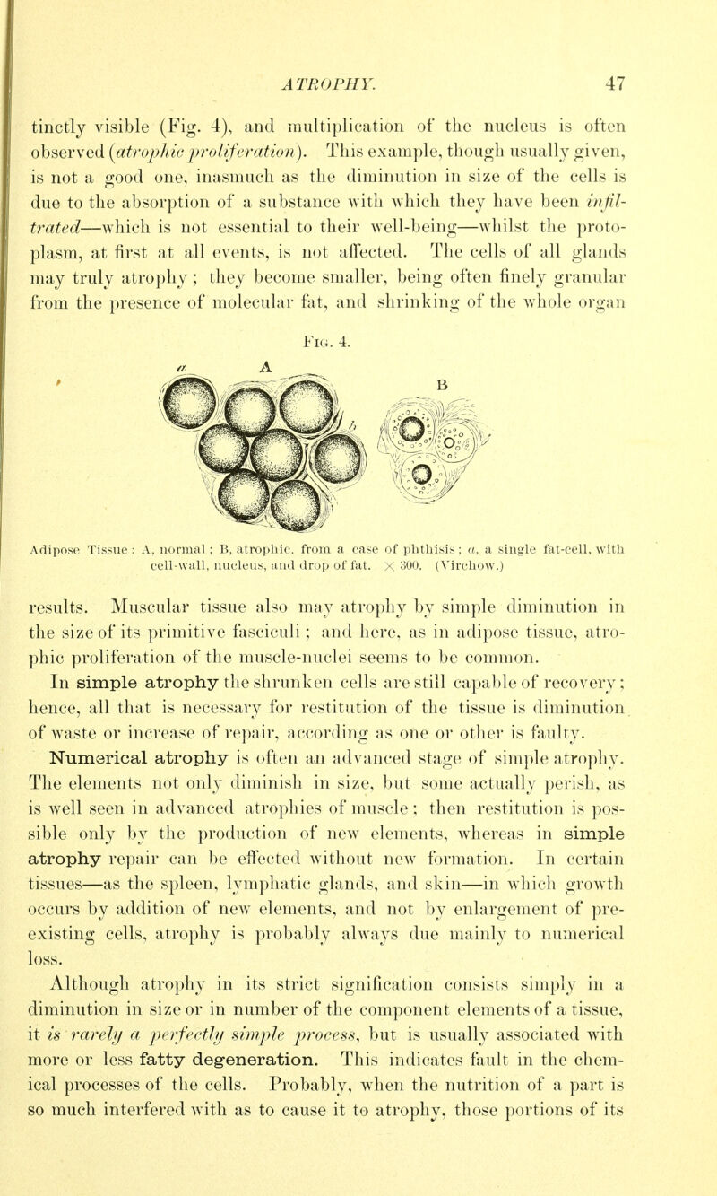 tinctly visible (Fig. 4), and multiplication of the nucleus is often observed (^atrophici^roliferation). This example, though usually given, is not a good one, inasmuch as the diminution in size of the cells is due to the absorption of a substance with which they have been infil- trated—which is not essential to their well-being—whilst the proto- plasm, at first at all events, is not affected. The cells of all glands may truly atrophy ; they become smaller, being often finely granular from the presence of molecular fat, and shrinking of the whole organ Fig. 4. Adipose Tissue: A, normal ; B, atrophic, from, a case of phthisis; a, a single fat-cell, with cell-wall, nucleus, and drop of fat. X 300. (Virchow.) results. Muscular tissue also may atrophy by simple diminution in the size of its primitive fasciculi; and here, as in adipose tissue, atro- phic proliferation of the muscle-nuclei seems to be common. In simple atrophy the shrunken cells are still capa1)le of recovery ; hence, all that is necessary for restitution of the tissue is diminution, of waste or increase of repair, according as one or other is faulty. Numerical atrophy is often an advanced stage of simple atrophy. The elements not only diminish in size, but some actually perish, as is well seen in advanced atrophies of muscle; then restitution is pos- sible only by the production of new elements, whereas in simple atrophy repair can be effected without new formation. In certain tissues—as the spleen, lymphatic glands, and skin—in which growth occurs by addition of new elements, and not by enlargement of pre- existing cells, atrophy is probably always due mainly to numerical loss. Although atrophy in its strict signification consists simply in a diminution in size or in number of the component elements of a tissue, it is rarely a perfectly simple process, but is usually associated with more or less fatty degeneration. This indicates fault in the chem- ical processes of the cells. Probably, when the nutrition of a part is so much interfered with as to cause it to atrophy, those portions of its