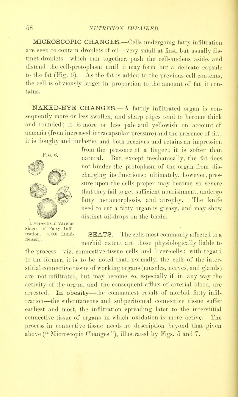 MICROSCOPIC CHANGES.—Cells undergoing fatty infiltration are seen to contain droplets of oil—very sm'all at first, but usually dis- tinct droplets—which run together, push the cell-nucleus aside, and distend the cell-protoplasm until it may form but a delicate capsule to the fat (Fig. 6). As the fat is added to the previous cell-contents, the cell is obviously larger in proportion to the amount of fat it con- tains. NAKED-EYE CHANGES.—A fattily infiltrated organ is con- sequently more or less swollen, and sharp edges tend to become thick and rounded; it is more or less pale and yellowish on account of anaemia (from increased intracapsular pressure) and the-presence of fiit; it is doughy and inelastic, and both receives and retains an impression from the pressure of a finger; it is softer than ^' natural. But, except mechanically, the fat does not hinder the protoplasm of the organ from dis- ^^^) charging its functions: ultimately, however, pres- sure upon the cells proper may become so severe that they fail to get sufficient nourishment, undergo fatty metamorphosis, and atrophy. The knife used to cut a fatty organ is greasy, and may show distinct oil-drops on the blade. Liver-eells in Various stages of Fatty Infil- tration. X 300 (Rind- SEATS.—The cells most commonly aff'ected to a morbid extent are those physiologically liable to the process—viz. connective-tissue cells and liver-cells : with regard to the former, it is to be noted that, normally, the cells of the inter- stitial connective tissue of working organs (muscles, nerves, and glands) are not infiltrated, but may become so, especially if in any way the activity of the organ, and the consequent afflux of arterial blood, are arrested. In obesity—the commonest result of morbid fatty infil- tration—the subcutaneous and subperitoneal connective tissue suff*er earliest and most, the infiltration spreading later to the interstitial connective tissue of organs in wdiich oxidation is more active. The process in connective tissue needs no description beyond that given above ( Microscopic Changes), illustrated by Figs, o and 7.