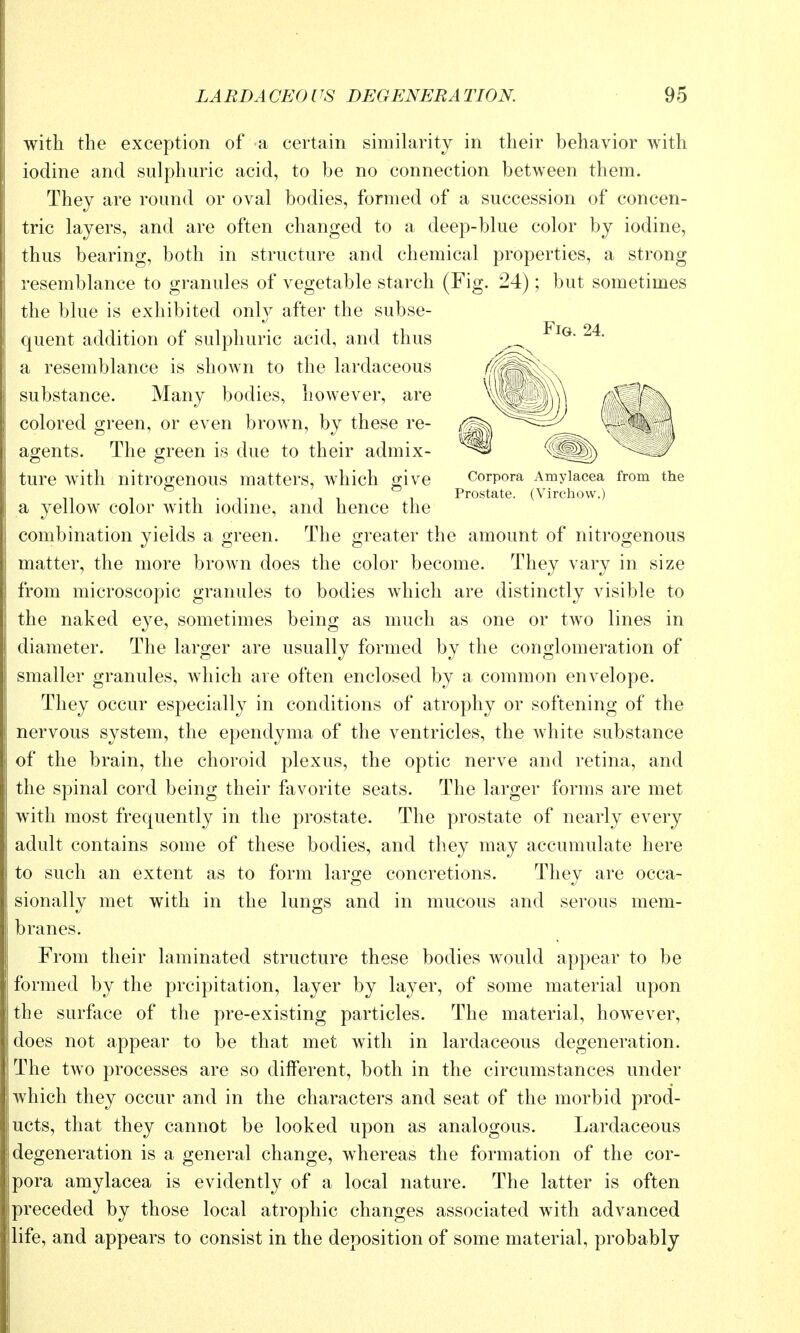 with the exception of a certain similarity in their behavior with iodine and sulphuric acid, to be no connection between them. They are round or oval bodies, formed of a succession of concen- tric layers, and are often changed to a deep-blue color by iodine, thus bearing, both in structure and chemical properties, a strong resemblance to granules of vegetable starch (Fig. 24); but sometimes the blue is exhibited onh^ after the subse- quent addition of sulphuric acid, and thus a resemblance is shown to the lardaceous substance. Many bodies, however, are colored o;reen, or even brown, by these re- agents. The green is due to their admix- FiG. 24. Corpora Amylacea from the Prostate. (Virchow.) ture with nitrogenous matters, which give a yellow color with iodine, and hence the combination yields a green. The greater the amount of nitrogenous matter, the more brown does the color become. They vary in size from microscopic granules to bodies which are distinctly visible to the naked eye, sometimes being as much as one or two lines in diameter. The larger are usually formed by the conglomeration of smaller granules, which are often enclosed by a common envelope. They occur especially in conditions of atrophy or softening of the nervous system, the ependyma of the ventricles, the white substance of the brain, the choroid plexus, the optic nerve and retina, and the spinal cord being their favorite seats. The larger forms are met with most frequently in the prostate. The prostate of nearly every adult contains some of these bodies, and they may accumulate here to such an extent as to form large concretions. They are occa- sionally met with in the lungs and in mucous and serous mem- branes. From their laminated structure these bodies would appear to be formed by the prcipitation, layer by layer, of some material upon the surface of the pre-existing particles. The material, however, does not appear to be that met with in lardaceous degeneration. The two processes are so different, both in the circumstances under which they occur and in the characters and seat of the morbid prod- ucts, that they cannot be looked upon as analogous. Lardaceous degeneration is a general change, whereas the formation of the cor- pora amylacea is evidently of a local nature. The latter is often preceded by those local atrophic changes associated with advanced life, and appears to consist in the deposition of some material, probably
