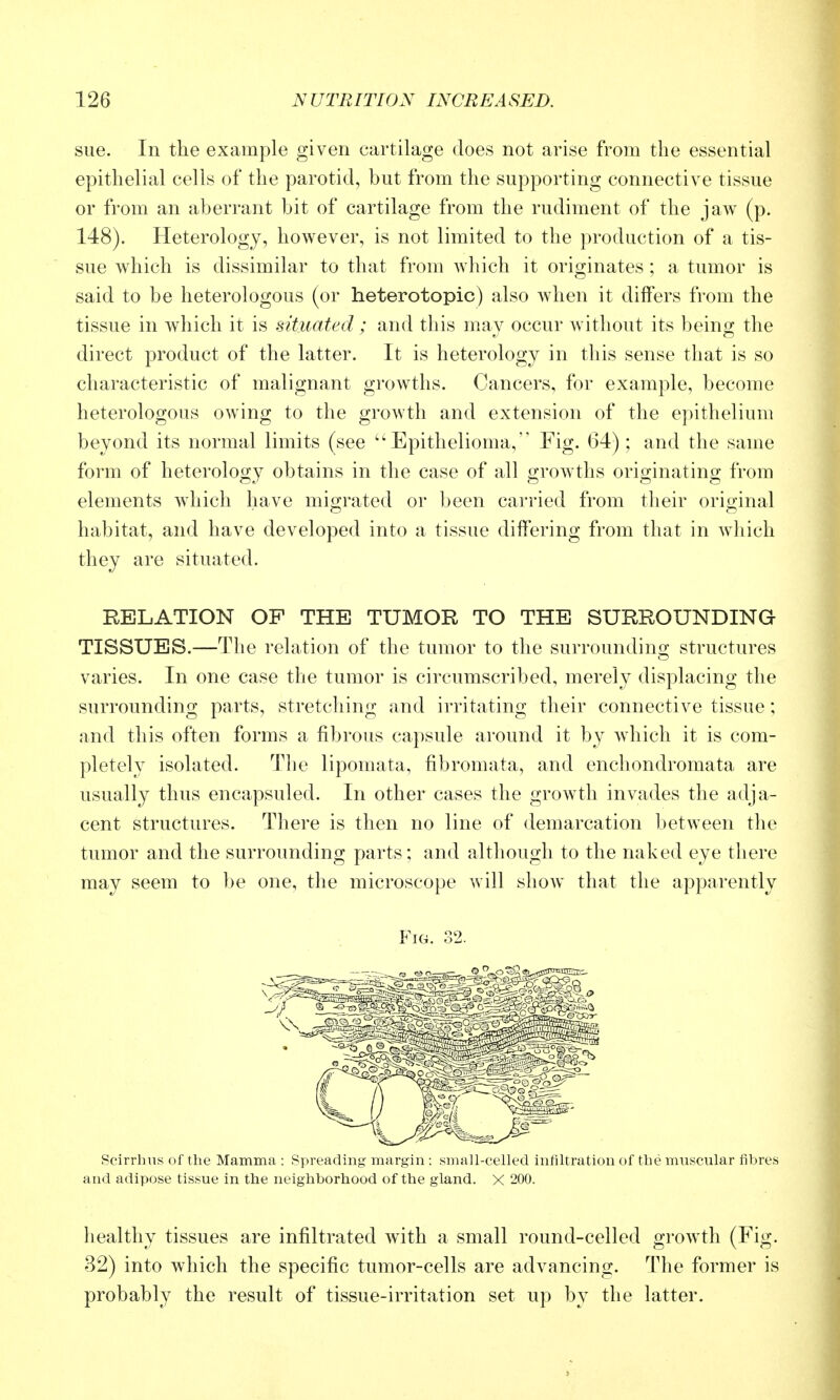 sue. In the example given cartilage does not arise from the essential epithelial cells of the parotid, but from the supporting connective tissue or from an aberrant bit of cartilage from the rudiment of the jaw (p. 148). Heterology, however, is not limited to the production of a tis- sue which is dissimilar to that from which it originates ; a tumor is said to be heterologous (or heterotopic) also when it differs from the tissue in Avliich it is situated ; and tliis mav occur without its beino; the direct product of the latter. It is heterology in this sense that is so characteristic of malignant growths. Cancers, for example, become heterologous owing to the growth and extension of the epithelium beyond its normal limits (see ''Epithelioma, Fig. 64); and the same form of heterology obtains in the case of all growths originating from elements which have migrated or been carried from their orio-inal habitat, and have developed into a tissue differing from that in which they are situated. RELATION OP THE TUMOR TO THE SURROUNDING TISSUES.—The relation of the tumor to the surrounding structures varies. In one case the tumor is circumscribed, merely displacing the surrounding parts, stretching and irritating their connective tissue; and this often forms a fibrous capsule around it by which it is com- pletely isolated. The lipomata, fibromata, and enchondromata are usually thus encapsuled. In other cases the growth invades the adja- cent structures. There is then no line of demarcation between the tumor and the surrounding parts; and although to the naked eye there may seem to be one, the microscope will show that the apparently Fig. 32. Seirrhus of the Mamma : Spreading margin : small-celled infiltration of the muscular fibres and adipose tissue in the neighborhood of the gland. X 200. healthy tissues are infiltrated with a small round-celled growth (Fig. 32) into which the specific tumor-cells are advancing. The former is probably the result of tissue-irritation set up by the latter.