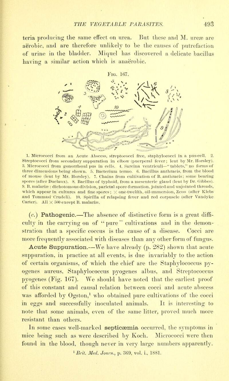 teria producing the same effect on urea. But these and M. ureae are aerobic, and are therefore unlikely to be the causes of putrefaction of urine in the bladder. Miquel has discovered a delicate bacillus having a similar action which is anaerobic. Fig. 167. 1. Micrococci from an Acute Abscess, streptococci free, staphylococci in a pus-cell. 2. Streptococci from secondary suppuration in elbow (puerperal fever; lent by Mr. Horsley). 3. Micrococci from gonorrhoeal pus in cells. 4. Sarcina ventriculi— tablets, no forms of three dimensions being shown. 5. Bacterium termo. 6. Bacillus anthracis, from the blood of mouse (lent by Mr. Horsley). 7. Chains from cultivation of B. anthracis; some bearing spores (after Duclaux). 8. Bacillus of typhoid, from a mesenteric gland (lent by Dr. Oibbes). 9. B. malaria : dichotomous division, parietal spore-formation, jointed and inijointed threads, which appear in cultures and fine spores; X one-twelfth, oil-immersion, Zeiss (after Klebs and Tommasi Crudeli). 10. Spirilla of relapsing fever and red corpuscle (after Vandylce Carter). All X 500 except B. malariae. (c.) Pathogenic.—The absence of distinctive form is a great diffi- culty in the carrying on of pure cultivations and in the demon- stration that a specific coccus is the cause of a disease. Cocci are more fre(|uently associated with diseases than any other form of fungus. Acute Suppuration.—We have already (p. 282) shown that acute suppuration, in practice at all events, is due invariably to the action of certain organisms, of which the chief are the Staphylococcus py- ogenes aureus. Staphylococcus pyogenes albus, and Streptococcus pyogenes (Fig. 167). We should have noted that the earliest proof of this constant and causal relation between cocci and acute abscess was afforded by Ogston,^ who obtained pure cultivations of the cocci in eggs and successfully inoculated animals. It is interesting to note that some animals, even of the same litter, proved much more resistant than others. In some cases well-marked septicaemia occurred, the symptoms in mice being such as were described by Koch. Micrococci were then found in the blood, though never in very large numbers apparently. ^Brit. Med. Journ., p. 369, vol. i., 1881.