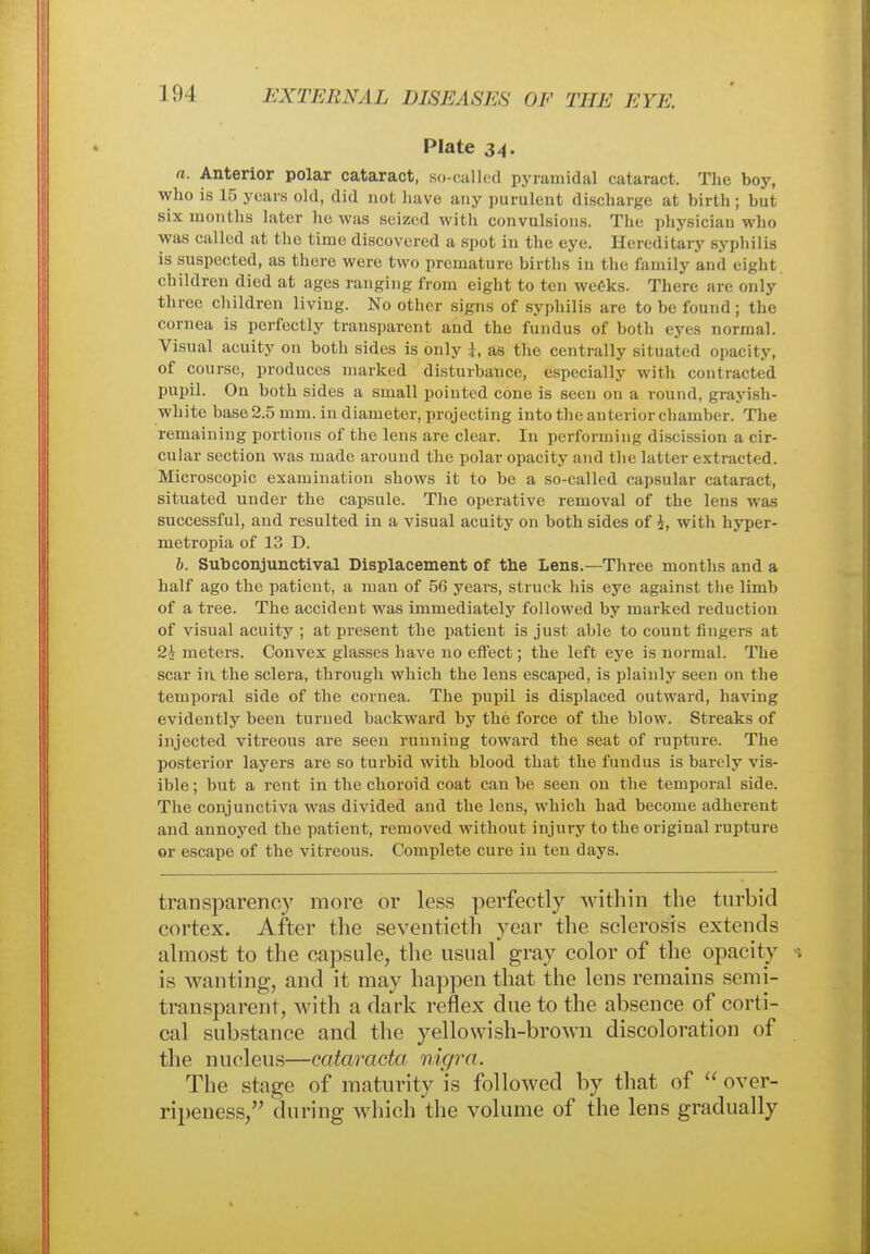 Plate 34. a. Anterior polar cataract, so-called pyramidal cataract. The boy, who is 15 years old, did not have any purulent discharge at birth ; but six months later lie was seized with convulsions. The physician who was called at the time discovered a spot in the eye. Hereditary syphilis is suspected, as there were two premature birtbs in the family and eight children died at ages ranging from eight to ten weeks. There are only three children living. No other signs of syphilis are to be found; the cornea is perfectly transparent and the fundus of both eyes normal. Visual acuity on both sides is only ], as the centrally situated opacity, of course, produces marked disturbance, especially with contracted pupil. On both sides a small pointed cone is seen on a round, grayish- white base 2.5 mm. in diameter, projecting into the anterior chamber. The remaining portions of the lens are clear. In performing discission a cir- cular section was made around the polar opacity and the latter extracted. Microscopic examination shows it to be a so-called capsular cataract, situated under the capsule. The operative removal of the lens was successful, and resulted in a visual acuity on both sides of i, with hyper- metropia of 13 D. b. Subconjunctival Displacement of the Lens.—Three months and a half ago the patient, a man of 56 years, struck his eye against the limb of a tree. The accident was immediately followed by marked reduction of visual acuity ; at present the patient is just able to count fingers at 2i meters. Convex glasses have no effect; the left eye is normal. The scar in the sclera, through which the lens escaped, is plainly seen on the temporal side of the cornea. The pupil is displaced outward, having evidently been turned backward by the force of the blow. Streaks of injected vitreous are seen running toward the seat of rupture. The posterior layers are so turbid with blood that the fundus is barely vis- ible; but a rent in the choroid coat can be seen on the temporal side. The conjunctiva was divided and the lens, which had become adherent and annoyed the patient, removed without injury to the original rupture or escape of the vitreous. Complete cure in ten days. transparency more or less perfectly within the turbid cortex. After the seventieth year the sclerosis extends almost to the capsule, the usual gray color of the opacity is wanting, and it may happen that the lens remains semi- transparent, with a dark reflex due to the absence of corti- cal substance and the yellowish-brown discoloration of the nucleus—Cataracta nigra. The stage of maturity is followed by that of  over- ripeness, during which the volume of the lens gradually