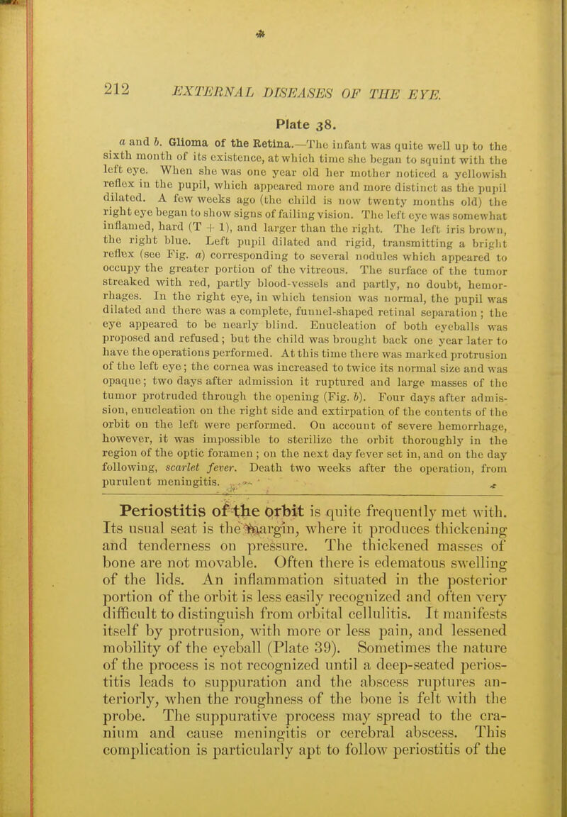 Plate 38. a and b. Glioma of the Retina.—The infant was quite well up to the sixth month of its existence, at which time she began to squint with the left eye. When she was one year old her mother noticed a yellowish reflex in the pupil, which appeared more and more distinct as the pupil dilated. A few weeks ago (the child is now twenty months old) the right eye began to show signs of failing vision. The left eye was somewhat inflamed, hard (T + 1), and larger than the right. The left iris brown, the right blue. Left pupil dilated and rigid, transmitting a bright reflex (see Fig. a) corresponding to several nodules which appeared to occupy the greater portion of the vitreous. The surface of the tumor streaked with red, partly blood-vessels and partly, no doubt, hemor- rhages. In the right eye, in which tension was normal, the pupil was dilated and there was a complete, funnel-shaped retinal separation ; the eye appeared to be nearly blind. Enucleation of both eyeballs was proposed and refused; but the child was brought back one year later to have the operations performed. At this time there was marked protrusion of the left eye; the cornea was increased to twice its normal size and was opaque; two days after admission it ruptured and large masses of the tumor protruded through the opening (Fig. 6). Four days after admis- sion, enucleation on the right side and extirpation of the contents of the orbit on the left were performed. Ou account of severe hemorrhage, however, it was impossible to sterilize the orbit thoroughly in the region of the optic foramen ; on the next day fever set in, and on the day following, scarlet fever. Death two weeks after the operation, from purulent meningitis. „. - - ' t Periostitis of the Orbit is quite frequently met with. Its usual seat is the %argin, where it produces thickening and tenderness on pressure. The thickened masses of bone are not movable. Often there is edematous swelling of the lids. An inflammation situated in the posterior portion of the orbit is less easily recognized and often very difficult to distinguish from orbital cellulitis. It manifests itself by protrusion, with more or less pain, and lessened mobility of the eyeball (Plate 39). Sometimes the nature of the process is not recognized until a deep-seated perios- titis leads to suppuration and the abscess ruptures an- teriorly, when the roughness of the bone is felt with the probe. The suppurative process may spread to the cra- nium and cause meningitis or cerebral abscess. This complication is particularly apt to follow periostitis of the