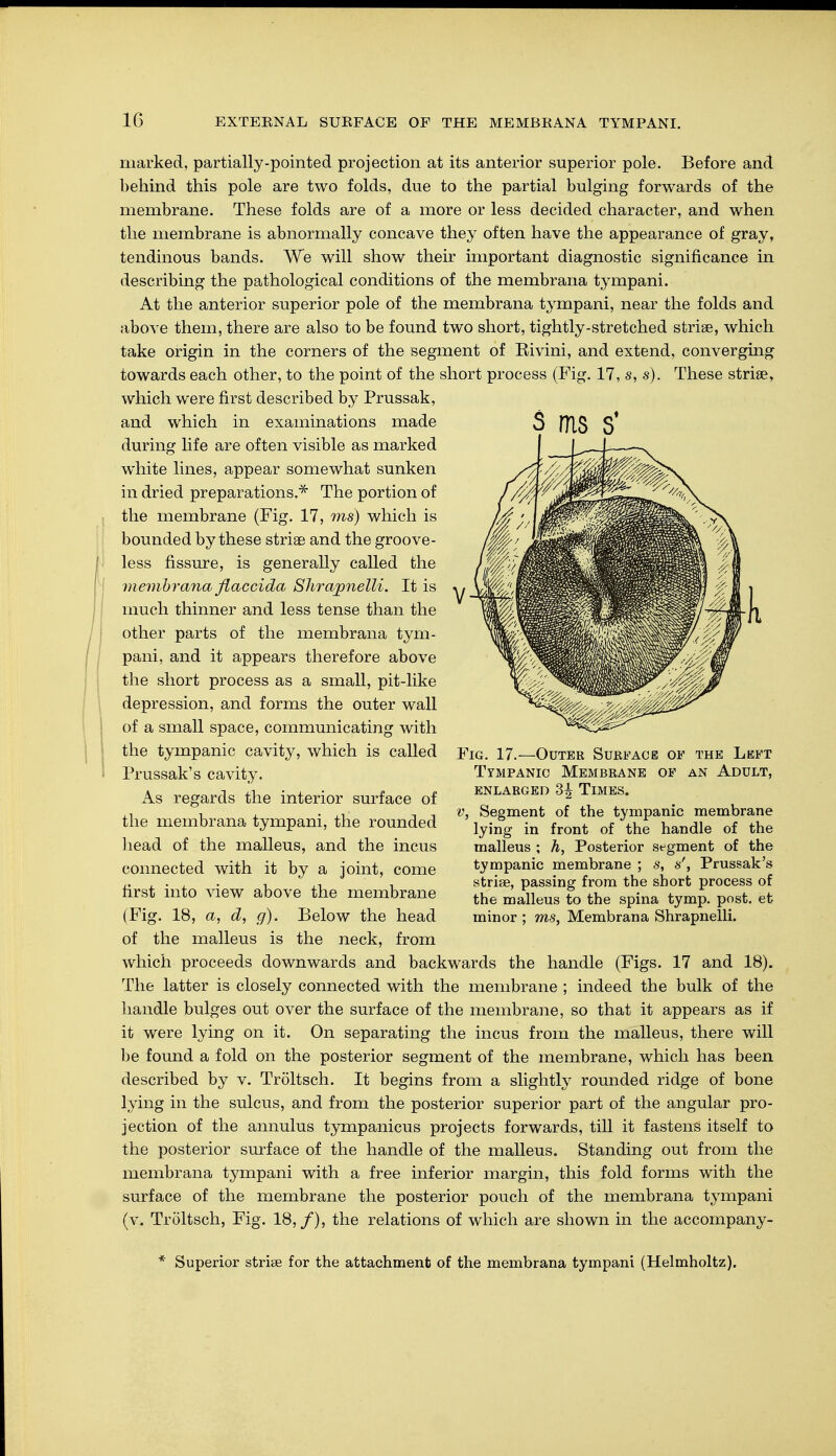 marked, partially-pointed projection at its anterior superior pole. Before and behind this pole are two folds, due to the partial bulging forwards of the membrane. These folds are of a more or less decided character, and when the membrane is abnormally concave they often have the appearance of gray, tendinous bands. We will show their important diagnostic significance in describing the pathological conditions of the membrana tympani. At the anterior superior pole of the membrana tympani, near the folds and above them, there are also to be found two short, tightly-stretched striae, which take origin in the corners of the segment of Eivini, and extend, converging towards each other, to the point of the short process (Fig. 17, s, s). These stria?, which were first described by Prussak, and which in examinations made during life are often visible as marked white lines, appear somewhat sunken in dried preparations.* The portion of the membrane (Fig. 17, ms) which is bounded by these strise and the groove- less fissure, is generally called the membrana flaccida Shrapnelli. It is much thinner and less tense than the other parts of the membrana tym- pani, and it appears therefore above the short process as a small, pit-like depression, and forms the outer wall of a small space, communicating with the tympanic cavity, which is called Prussak's cavity. As regards the interior surface of the membrana tympani, the rounded head of the malleus, and the incus connected with it by a joint, come first into view above the membrane (Fig. 18, a, d, g). Below the head of the malleus is the neck, from which proceeds downwards and backwards the handle (Figs. 17 and 18). The latter is closely connected with the membrane ; indeed the bulk of the handle bulges out over the surface of the membrane, so that it appears as if it were lying on it. On separating the incus from the malleus, there will be found a fold on the posterior segment of the membrane, which has been described by v. Tröltsch. It begins from a slightly rounded ridge of bone lying in the sulcus, and from the posterior superior part of the angular pro- jection of the annulus tympanicus projects forwards, till it fastens itself to the posterior surface of the handle of the malleus. Standing out from the membrana tympani with a free inferior margin, this fold forms with the surface of the membrane the posterior pouch of the membrana tympani (v. Tröltsch, Fig. 18,/), the relations of which are shown in the accompany- * Superior strise for the attachment of the membrana tympani (Helmholtz). Fig. 17.—Outer Surface of the Left Tympanic Membrane of an Adult, ENLARGED 3^ TlMES. v, Segment of the tympanic membrane lying in front of the handle of the malleus ; h, Posterior segment of the tympanic membrane ; s, s', Prussak's striae, passing from the short process of the malleus to the spina tymp. post, et minor ; ms, Membrana Shrapnelli.