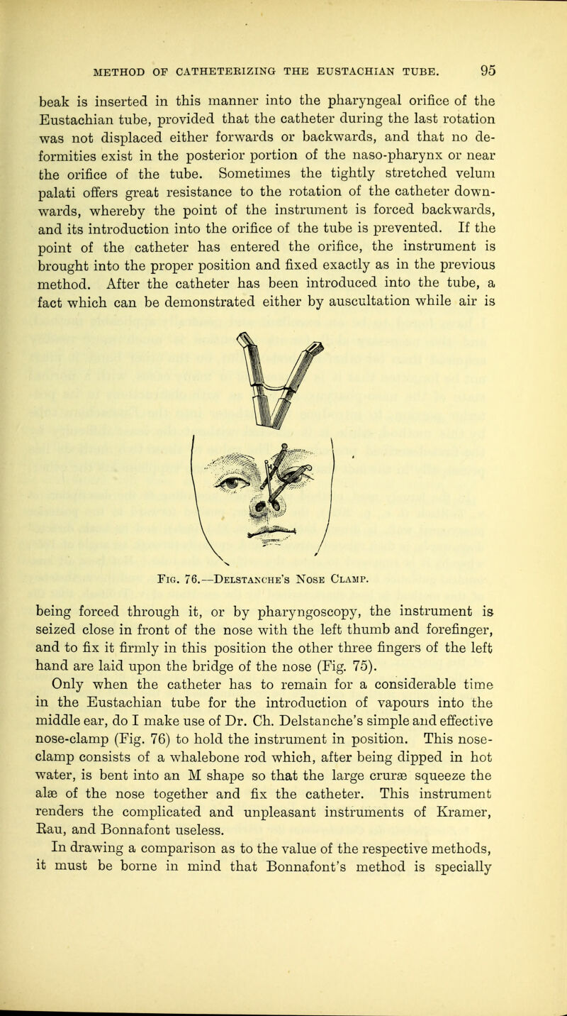 beak is inserted in this manner into the pharyngeal orifice of the Eustachian tube, provided that the catheter during the last rotation was not displaced either forwards or backwards, and that no de- formities exist in the posterior portion of the naso-pharynx or near the orifice of the tube. Sometimes the tightly stretched velum palati offers great resistance to the rotation of the catheter down- wards, whereby the point of the instrument is forced backwards, and its introduction into the orifice of the tube is prevented. If the point of the catheter has entered the orifice, the instrument is brought into the proper position and fixed exactly as in the previous method. After the catheter has been introduced into the tube, a fact which can be demonstrated either by auscultation while air is being forced through it, or by pharyngoscopy, the instrument is seized close in front of the nose with the left thumb and forefinger, and to fix it firmly in this position the other three fingers of the left hand are laid upon the bridge of the nose (Fig. 75). Only when the catheter has to remain for a considerable time in the Eustachian tube for the introduction of vapours into the middle ear, do I make use of Dr. Ch. Delstanche's simple and effective nose-clamp (Fig. 76) to hold the instrument in position. This nose- clamp consists of a whalebone rod which, after being dipped in hot water, is bent into an M shape so that the large crurae squeeze the alse of the nose together and fix the catheter. This instrument renders the complicated and unpleasant instruments of Kramer, Eau, and Bonnafont useless. In drawing a comparison as to the value of the respective methods, it must be borne in mind that Bonnafont's method is specially Fig. 76.—Delstanche's Nose Clamp.