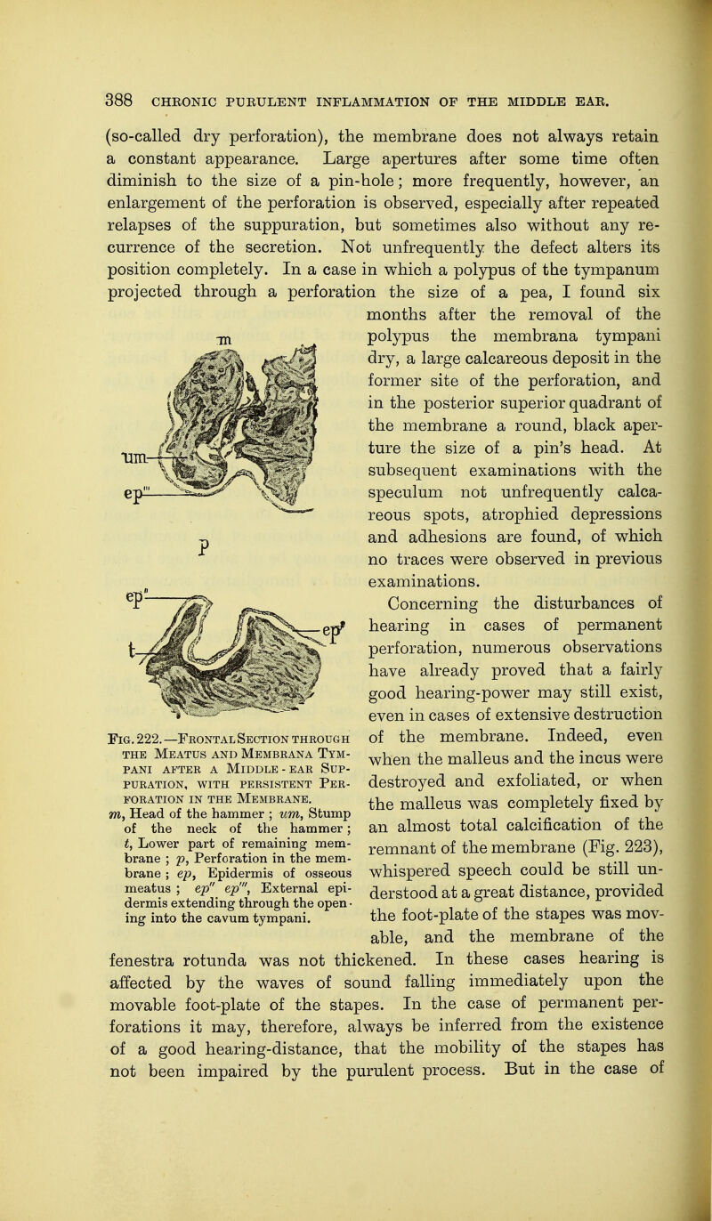 11m- (so-called dry perforation), the membrane does not always retain a constant appearance. Large apertures after some time often diminish to the size of a pin-hole; more frequently, however, an enlargement of the perforation is observed, especially after repeated relapses of the suppuration, but sometimes also without any re- currence of the secretion. Not unfrequently the defect alters its position completely. In a case in which a polypus of the tympanum projected through a perforation the size of a pea, I found six months after the removal of the polypus the membrana tympani dry, a large calcareous deposit in the former site of the perforation, and in the posterior superior quadrant of the membrane a round, black aper- ture the size of a pin's head. At subsequent examinations with the speculum not unfrequently calca- reous spots, atrophied depressions and adhesions are found, of which no traces were observed in previous examinations. Concerning the disturbances of hearing in cases of permanent perforation, numerous observations have already proved that a fairly good hearing-power may still exist, even in cases of extensive destruction of the membrane. Indeed, even when the malleus and the incus were destroyed and exfoliated, or when the malleus was completely fixed by an almost total calcification of the remnant of the membrane (Fig. 223), whispered speech could be still un- derstood at a great distance, provided the foot-plate of the stapes was mov- able, and the membrane of the fenestra rotunda was not thickened. In these cases hearing is affected by the waves of sound falling immediately upon the movable foot-plate of the stapes. In the case of permanent per- forations it may, therefore, always be inferred from the existence of a good hearing-distance, that the mobility of the stapes has not been impaired by the purulent process. But in the case of Fig. 222. —Frontal Section through the Meatus and Membrana Tym- pani after a Middle - ear Sup- puration, with persistent Per- foration in the Membrane. m, Head of the hammer ; urn, Stump of the neck of the hammer; t, Lower part of remaining mem- brane ; p, Perforation in the mem- brane ; ep, Epidermis of osseous meatus ; ep ep', External epi- dermis extending through the open • ing into the cavum tympani.