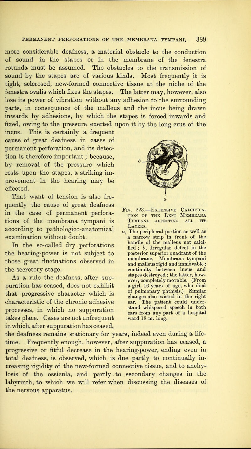 more considerable deafness, a material obstacle to the conduction of sound in the stapes or in the membrane of the fenestra rotunda must be assumed. The obstacles to the transmission of sound by the stapes are of various kinds. Most frequently it is tight, sclerosed, new-formed connective tissue at the niche of the fenestra ovalis which fixes the stapes. The latter may, however, also lose its power of vibration without any adhesion to the surrounding parts, in consequence of the malleus and the incus being drawn inwards by adhesions, by which the stapes is forced inwards and fixed, owing to the pressure exerted upon it by the long crus of the incus. This is certainly a frequent cause of great deafness in cases of permanent perforation, and its detec- tion is therefore important; because, by removal of the pressure which rests upon the stapes, a striking im- provement in the hearing may be effected. That want of tension is also fre- quently the cause of great deafness in the case of permanent perfora- tions of the membrana tympani is according to pathologico-anatomical examination without doubt. In the so-called dry perforations the hearing-power is not subject to those great fluctuations observed in the secretory stage. As a rule the deafness, after sup- puration has ceased, does not exhibit that progressive character which is characteristic of the chronic adhesive processes, in which no suppuration takes place. Cases are not unfrequent in which, after suppuration has ceased, the deafness remains stationary for years, indeed even during a life- time. Frequently enough, however, after suppuration has ceased, a progressive or fitful decrease in the hearing-power, ending even in total deafness, is observed, which is due partly to continually in- creasing rigidity of the new-formed connective tissue, and to anchy- losis of the ossicula, and partly to secondary changes in the labyrinth, to which we will refer when discussing the diseases of the nervous apparatus. a Fig. 223.—Extensive Calcifica- tion of the Left Membrana Tympani, affecting all its Layers. a, The peripheral poition as well as a narrow strip in front of the handle of the malleus not calci- fied ; b, Irregular defect in the posterior superior quadrant of the membrane. Membrana tympani and malleus rigid and immovable; continuity between incus and stapes destroyed; the latter, how- ever, completely movable. (From a girl, 16 years of age, who died of pulmonary phthisis.) Similar changes also existed in the right ear. The patient could under- stand whispered speech in both ears from any part of a hospital ward 18 m. long.