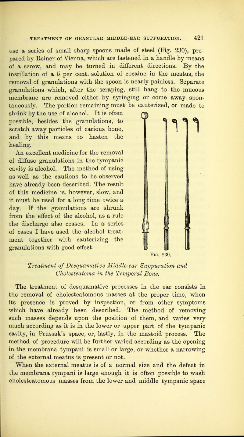 use a series of small sharp spoons made of steel (Fig. 230), pre- pared by Eeiner of Vienna, which are fastened in a handle by means of a screw, and may be turned in different directions. By the instillation of a 5 per cent, solution of cocaine in the meatus, the removal of granulations with the spoon is nearly painless. Separate granulations which, after the scraping, still hang to the mucous membrane are removed either by syringing or come away spon- taneously. The portion remaining must be cauterized, or made to shrink by the use of alcohol. It is often possible, besides the granulations, to scratch away particles of carious bone, and by this means to hasten the healing. An excellent medicine for the removal of diffuse granulations in the tympanic cavity is alcohol. The method of using as well as the cautions to be observed have already been described. The result of this medicine is, however, slow, and it must be used for a long time twice a day. If the granulations are shrunk from the effect of the alcohol, as a rule the discharge also ceases. In a series of cases I have used the alcohol treat- ment together with cauterizing the granulations with good effect. Fig. 230. Treatment of Desquamative Middle-ear Suppuration and Cholesteatoma in the Temporal Bone. The treatment of desquamative processes in the ear consists in the removal of cholesteatomous masses at the proper time, when its presence is proved by inspection, or from other symptoms which have already been described. The method of removing such masses depends upon the position of them, and varies very much according as it is in the lower or upper part of the tympanic cavity, in Prussak's space, or, lastly, in the mastoid process. The method of procedure will be further varied according as the opening in the membrana tympani is small or large, or whether a narrowing of the external meatus is present or not. When the external meatus is of a normal size and the defect in the membrana tympani is large enough it is often possible to wash cholesteatomous masses from the lower and middle tympanic space