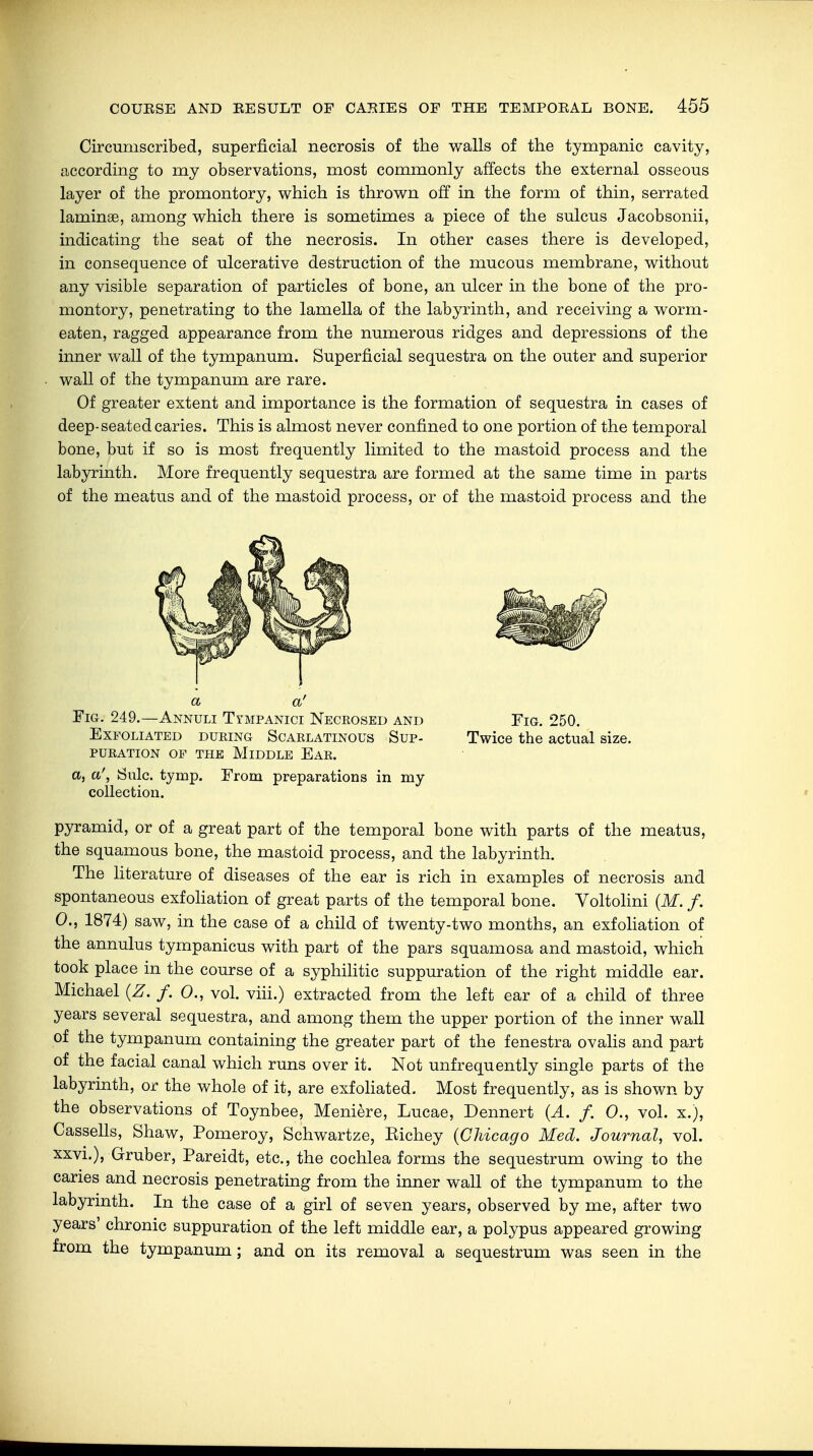 Circumscribed, superficial necrosis of the walls of the tympanic cavity, according to my observations, most commonly affects the external osseous layer of the promontory, which is thrown off in the form of thin, serrated laminae, among which there is sometimes a piece of the sulcus Jacobsonii, indicating the seat of the necrosis. In other cases there is developed, in consequence of ulcerative destruction of the mucous membrane, without any visible separation of particles of bone, an ulcer in the bone of the pro- montory, penetrating to the lamella of the labyrinth, and receiving a worm- eaten, ragged appearance from the numerous ridges and depressions of the inner wall of the tympanum. Superficial sequestra on the outer and superior wall of the tympanum are rare. Of greater extent and importance is the formation of sequestra in cases of deep-seated caries. This is almost never confined to one portion of the temporal bone, but if so is most frequently limited to the mastoid process and the labyrinth. More frequently sequestra are formed at the same time in parts of the meatus and of the mastoid process, or of the mastoid process and the a a' Fig. 249.—Annuli Tympanici Necrosed and Fig. 250. Exfoliated during Scarlatinous Sup- Twice the actual size. PURATION OP THE MlDDLE EAR. a, a', Sulc. tymp. From preparations in my collection. pyramid, or of a great part of the temporal bone with parts of the meatus, the squamous bone, the mastoid process, and the labyrinth. The literature of diseases of the ear is rich in examples of necrosis and spontaneous exfoliation of great parts of the temporal bone. Voltolini (M. f. 0., 1874) saw, in the case of a child of twenty-two months, an exfoliation of the annulus tympanicus with part of the pars squamosa and mastoid, which took place in the course of a syphilitic suppuration of the right middle ear. Michael (Z. f. 0., vol. viii.) extracted from the left ear of a child of three years several sequestra, and among them the upper portion of the inner wall of the tympanum containing the greater part of the fenestra ovalis and part of the facial canal which runs over it. Not unfrequently single parts of the labyrinth, or the whole of it, are exfoliated. Most frequently, as is shown by the observations of Toynbee, Meniere, Lucae, Dennert (A. f. 0., vol. x.), Cassells, Shaw, Pomeroy, Schwartze, Eichey (Chicago Med. Journal, vol. xxvi.), Gruber, Pareidt, etc., the cochlea forms the sequestrum owing to the caries and necrosis penetrating from the inner wall of the tympanum to the labyrinth. In the case of a girl of seven years, observed by me, after two years' chronic suppuration of the left middle ear, a polypus appeared growing from the tympanum; and on its removal a sequestrum was seen in the