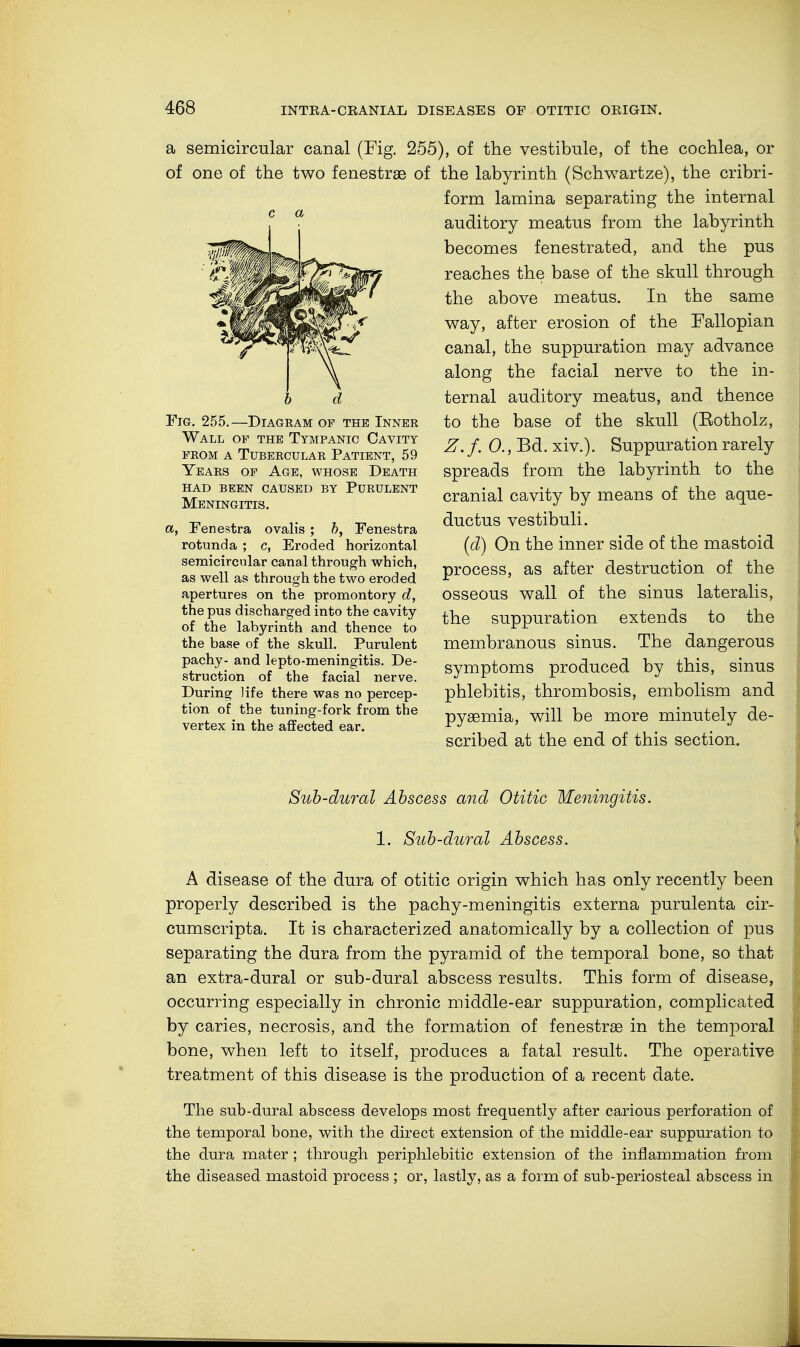 a semicircular canal (Fig. 255), of the vestibule, of the cochlea, or of one of the two fenestras of the labyrinth (Schwartze), the cribri- form lamina separating the internal auditory meatus from the labyrinth becomes fenestrated, and the pus reaches the base of the skull through the above meatus. In the same way, after erosion of the Fallopian canal, the suppuration may advance along the facial nerve to the in- ternal auditory meatus, and thence to the base of the skull (Eotholz, Z. f. 0., Bd. xiv.). Suppuration rarely spreads from the labyrinth to the cranial cavity by means of the aque- ductus vestibuli. (d) On the inner side of the mastoid process, as after destruction of the osseous wall of the sinus lateralis, the suppuration extends to the membranous sinus. The dangerous symptoms produced by this, sinus phlebitis, thrombosis, embolism and pyaemia, will be more minutely de- scribed at the end of this section. Sub-dural Abscess and Otitic Meningitis. 1. Sub-dural Abscess. A disease of the dura of otitic origin which has only recently been properly described is the pachy-meningitis externa purulenta cir- cumscripta. It is characterized anatomically by a collection of pus separating the dura from the pyramid of the temporal bone, so that an extra-dural or sub-dural abscess results. This form of disease, occurring especially in chronic middle-ear suppuration, complicated by caries, necrosis, and the formation of fenestras in the temporal bone, when left to itself, produces a fatal result. The operative treatment of this disease is the production of a recent date. The sub-dural abscess develops most frequently after carious perforation of the temporal bone, with the direct extension of the middle-ear suppuration to the dura mater ; through periphlebitic extension of the inflammation from the diseased mastoid process ; or, lastly, as a form of sub-periosteal abscess in c a b d Fig. 255.—Diagram of the Inner Wall of the Tympanic Cavity from a Tubercular Patient, 59 Years of Age, whose Death had been caused by purulent Meningitis. a, Fenestra ovalis ; b, Fenestra rotunda ; c, Eroded horizontal semicircular canal through which, as well as through the two eroded apertures on the promontory d, the pus discharged into the cavity of the labyrinth and thence to the base of the skull. Purulent pachy- and lepto-meningitis. De- struction of the facial nerve. During Jife there was no percep- tion of the tuning-fork from the vertex in the affected ear.