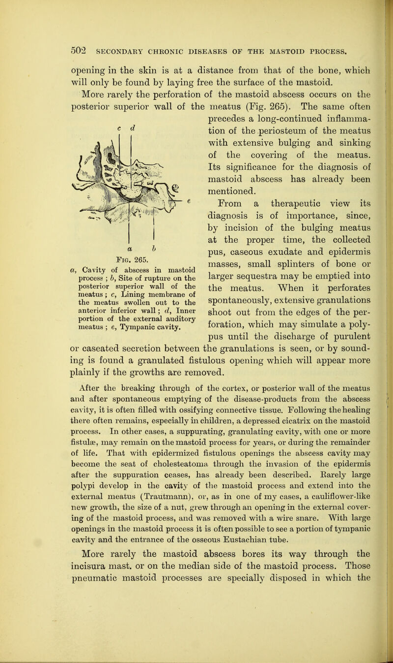 opening in the skin is at a distance from that of the bone, which will only be found by laying free the surface of the mastoid. More rarely the perforation of the mastoid abscess occurs on the posterior superior wall of the meatus (Fig. 265). The same often precedes a long-continued inflamma- tion of the periosteum of the meatus with extensive bulging and sinking of the covering of the meatus. Its significance for the diagnosis of mastoid abscess has already been mentioned. From a therapeutic view its diagnosis is of importance, since, by incision of the bulging meatus at the proper time, the collected pus, caseous exudate and epidermis masses, small splinters of bone or larger sequestra may be emptied into the meatus. When it perforates spontaneously, extensive granulations shoot out from the edges of the per- foration, which may simulate a poly- pus until the discharge of purulent or caseated secretion between the granulations is seen, or by sound- ing is found a granulated fistulous opening which will appear more plainly if the growths are removed. After the breaking through of the cortex, or posterior wall of the meatus and after spontaneous emptying of the disease-products from the abscess cavity, it is often filled with ossifying connective tissue. Following the healing there often remains, especially in children, a depressed cicatrix on the mastoid process. In other cases, a suppurating, granulating cavity, with one or more fistulse, may remain on the mastoid process for years, or during the remainder of life. That with epidermized fistulous openings the abscess cavity may become the seat of cholesteatoma through the invasion of the epidermis after the suppuration ceases, has already been described. Earely large polypi develop in the cavity of the mastoid process and extend into the external meatus (Trautmann), or, as in one of my cases, a cauliflower-like new growth, the size of a nut, grew through an opening in the external cover- ing of the mastoid process, and was removed with a wire snare. With large openings in the mastoid process it is often possible to see a portion of tympanic cavity and the entrance of the osseous Eustachian tube. More rarely the mastoid abscess bores its way through the incisura mast, or on the median side of the mastoid process. Those pneumatic mastoid processes are specially disposed in which the c d Fig. 265. a, Cavity of abscess in mastoid process ; b, Site of rupture on the posterior superior wall of the meatus; c, Lining membrane of the meatus swollen out to the anterior inferior wall; d, Inner portion of the external auditory meatus ; e, Tympanic cavity.