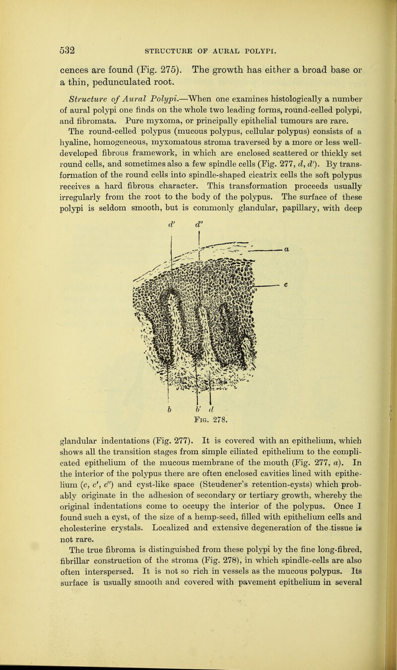 cences are found (Fig. 275). The growth has either a broad base or a thin, pedunculated root. Structure of Aural Polypi.—When one examines histologically a number of aural polypi one finds on the whole two leading forms, round-celled polypi, and fibromata. Pure myxoma, or principally epithelial tumours are rare. The round-celled polypus (mucous polypus, cellular polypus) consists of a hyaline, homogeneous, myxomatous stroma traversed by a more or less well- developed fibrous framework, in which are enclosed scattered or thickly set round cells, and sometimes also a few spindle cells (Fig. 277, d, d'). By trans- formation of the round cells into spindle-shaped cicatrix cells the soft polypus receives a hard fibrous character. This transformation proceeds usually irregularly from the root to the body of the polypus. The surface of these polypi is seldom smooth, but is commonly glandular, papillary, with deep d' d Fig. 278. glandular indentations (Fig. 277). It is covered with an epithelium, which shows all the transition stages from simple ciliated epithelium to the compli- cated epithelium of the mucous membrane of the mouth (Fig. 277, a). In the interior of the polypus there are often enclosed cavities lined with epithe- lium (c, c', c) and cyst-like space (Steudener's retention-cysts) which prob- ably originate in the adhesion of secondary or tertiary growth, whereby the original indentations come to occupy the interior of the polypus. Once I found such a cyst, of the size of a hemp-seed, filled with epithelium cells and Cholesterine crystals. Localized and extensive degeneration of the .tissue is not rare. The true fibroma is distinguished from these polypi by the fine long-fibred, fibrillar construction of the stroma (Fig. 278), in which spindle-cells are also often interspersed. It is not so rich in vessels as the mucous polypus. Its surface is usually smooth and covered with pavement epithelium in several