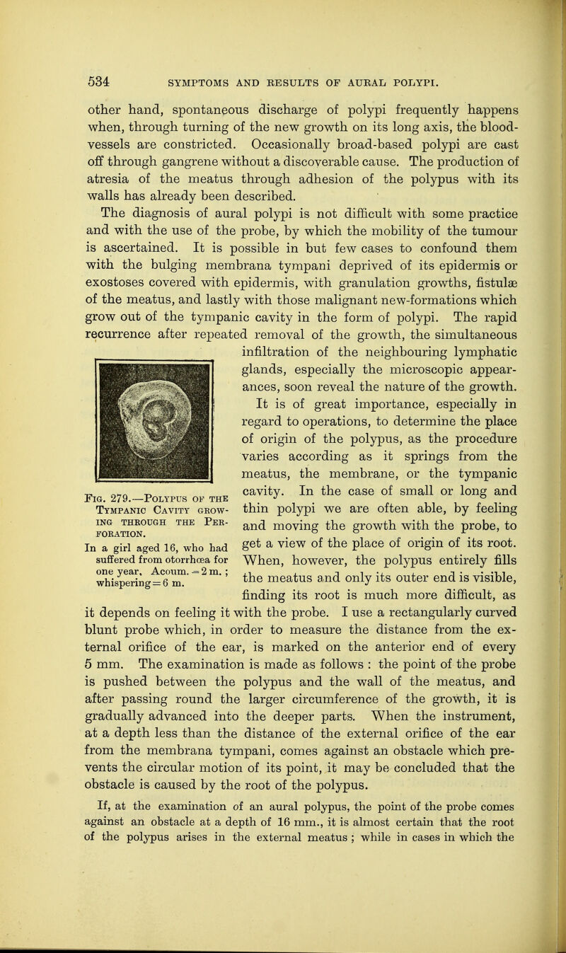 other hand, spontaneous discharge of polypi frequently happens when, through turning of the new growth on its long axis, the blood- vessels are constricted. Occasionally broad-based polypi are cast off through gangrene without a discoverable cause. The production of atresia of the meatus through adhesion of the polypus with its walls has already been described. The diagnosis of aural polypi is not difficult with some practice and with the use of the probe, by which the mobility of the tumour is ascertained. It is possible in but few cases to confound them with the bulging membrana tympani deprived of its epidermis or exostoses covered with epidermis, with granulation growths, fistulae of the meatus, and lastly with those malignant new-formations which grow out of the tympanic cavity in the form of polypi. The rapid recurrence after repeated removal of the growth, the simultaneous infiltration of the neighbouring lymphatic glands, especially the microscopic appear- ances, soon reveal the nature of the growth. It is of great importance, especially in regard to operations, to determine the place of origin of the polypus, as the procedure varies according as it springs from the meatus, the membrane, or the tympanic cavity. In the case of small or long and thin polypi we are often able, by feeling and moving the growth with the probe, to get a view of the place of origin of its root. When, however, the polypus entirely fills the meatus and only its outer end is visible, finding its root is much more difficult, as it depends on feeling it with the probe. I use a rectangularly curved blunt probe which, in order to measure the distance from the ex- ternal orifice of the ear, is marked on the anterior end of every 5 mm. The examination is made as follows : the point of the probe is pushed between the polypus and the wall of the meatus, and after passing round the larger circumference of the growth, it is gradually advanced into the deeper parts. When the instrument, at a depth less than the distance of the external orifice of the ear from the membrana tympani, comes against an obstacle which pre- vents the circular motion of its point, it may be concluded that the obstacle is caused by the root of the polypus. If, at the examination of an aural polypus, the point of the probe comes against an obstacle at a depth of 16 mm., it is almost certain that the root of the polypus arises in the external meatus ; while in cases in which the Fig. 279.—Polypus of the Tympanic Cavity grow- ing THROUGH THE PER- FORATION. In a girl aged 16, who had suffered from otorrhcea for one year, Acoum. -= 2 m. ; whisperings 6 m.