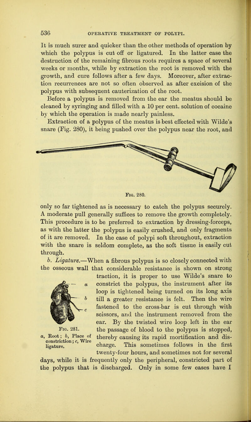 It is much surer and quicker than the other methods of operation by which the polypus is cut off or ligatured. In the latter case the destruction of the remaining fibrous roots requires a space of several weeks or months, while by extraction the root is removed with the growth, and cure follows after a few days. Moreover, after extrac- tion recurrences are not so often observed, as after excision of the polypus with subsequent cauterization of the root. Before a polypus is removed from the ear the meatus should be cleaned by syringing and filled with a 10 per cent, solution of cocaine by which the operation is made nearly painless. Extraction of a polypus of the meatus is best effected with Wilde's snare (Fig. 280), it being pushed over the polypus near the root, and Fig. 280. only so far tightened as is necessary to catch the polypus securely. A moderate pull generally suffices to remove the growth completely. This procedure is to be preferred to extraction by dressing-forceps, as with the latter the polypus is easily crushed, and only fragments of it are removed. In the case of polypi soft throughout, extraction with the snare is seldom complete, as the soft tissue is easily cut through. b. Ligature.—When a fibrous polypus is so closely connected with the osseous wall that considerable resistance is shown on strong traction, it is proper to use Wilde's snare to constrict the polypus, the instrument after its loop is tightened being turned on its long axis till a greater resistance is felt. Then the wire fastened to the cross-bar is cut through with scissors, and the instrument removed from the ear. By the twisted wire loop left in the ear the passage of blood to the polypus is stopped, thereby causing its rapid mortification and dis- charge. This sometimes follows in the first twenty-four hours, and sometimes not for several days, while it is frequently only the peripheral, constricted part of the polypus that is discharged. Only in some few cases have I Fig. 281. a, Root; b, Place of constriction; c, Wire ligature.