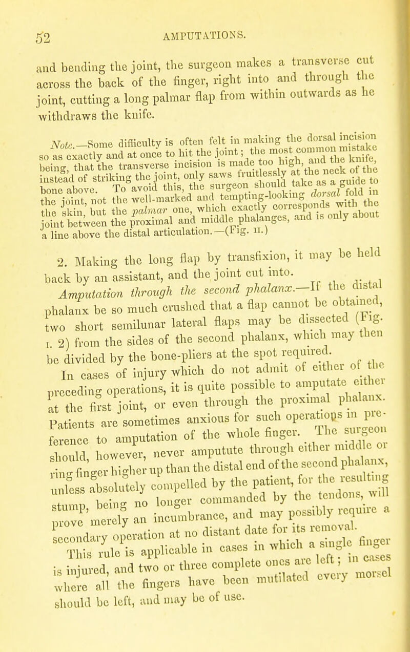 and bending the joint, the surgeon makes a transverse cut across the back of the finger, right into and through the joint, cutting a long palmar flap from within outwards as he withdraws the knife. Naff Some difficulty is often felt in making the dorsal incision so^° e6x7ctlyand at oncl to hit the joint; the ™tco=^ being, that the transverse incision is ^*°°^t{^of the instead of striking the joint, only saws fruitles y at *e neck ot t» e bone above To avoid this, the surgeon should take as a guioe to the iointnot the well-marked and tempting-looking dorsal fold in a line above the distal articulation.—(tig. n.) 2. Making the long flap by transfixion, it may be held back by an assistant, and the joint cut into. Amputation through the second phalanx.—U the distal phalanx be so much crushed that a flap cannot be obtained, two short semilunar lateral flaps may be dissected (Fig. ! 2) from the sides of the second phalanx, which may then be divided by the bone-pliers at the spot purred In cases of injury which do not admit of preceding operations, it is quite possible to amputate either a the first joint, or even through the proximal phalanx. Patients aJsom'etimes anxious tor such op-^sm in- ference to amputation of the whole finger. The surgeon sWd however, never amputute through either middle oi Sg higher up than the distal end of the second phalanx :fess fbsol^ely compelled by thepatient £ t e - 1 stump being no longer commanded by the tendons, ,ww pH merely an incumbrance, and may possibly require a ond ry operation at no distant date for its rem oval This ruJis applicable in cases in which a smglo fi*fi is injured, and two or three co^ete= W^-^J where all the fingers have been mutilated eve y should be left, and may be of use.