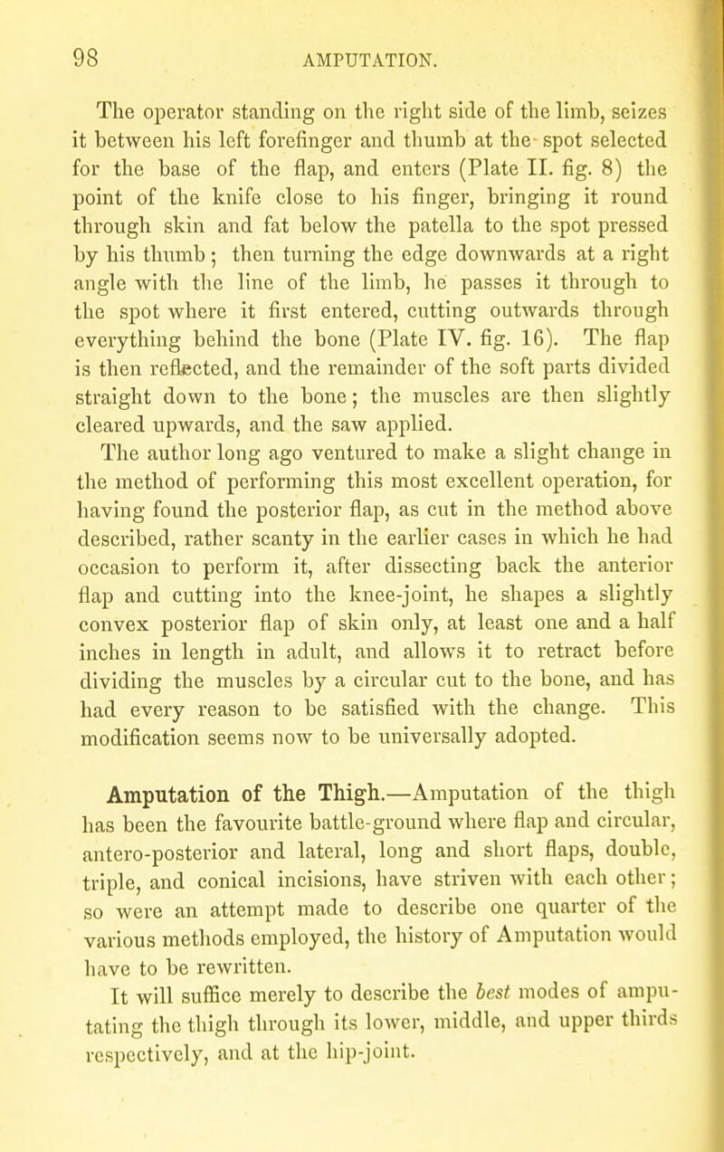 The operator standing on the right side of the limb, seizes it between his left forefinger and thumb at the- spot selected for the base of the flap, and enters (Plate II. fig. 8) the point of the knife close to his finger, bringing it round through skin and fat below the patella to the spot pressed by his tlmmb ; then turning the edge downwards at a right angle with the line of the limb, he passes it through to the spot where it first entered, cutting outwards through everything behind the bone (Plate IV. fig. 16). The flap is then reflected, and the remainder of the soft parts divided straight down to the bone; the muscles are then slightly cleared upwards, and the saw applied. The author long ago ventured to make a slight change in the method of performing this most excellent operation, for having found the posterior flap, as cut in the method above described, rather scanty in the earlier cases in which he had occasion to perform it, after dissecting back the anterior flap and cutting into the knee-joint, he shapes a slightly convex posterior flap of skin only, at least one and a half inches in length in adult, and allows it to retract before dividing the muscles by a circular cut to the bone, aud has had every reason to be satisfied with the change. This modification seems now to be universally adopted. Amputation of the Thigh.—Amputation of the thigh has been the favourite battle-ground where flap and circular, antero-posterior and lateral, long and short flaps, double, triple, and conical incisions, have striven with each other; so were an attempt made to describe one quarter of the various methods employed, the history of Amputation would have to be rewritten. It will suffice merely to describe the best modes of ampu- tating the thigh through its lower, middle, and upper thirds respectively, and at the hip-joint.