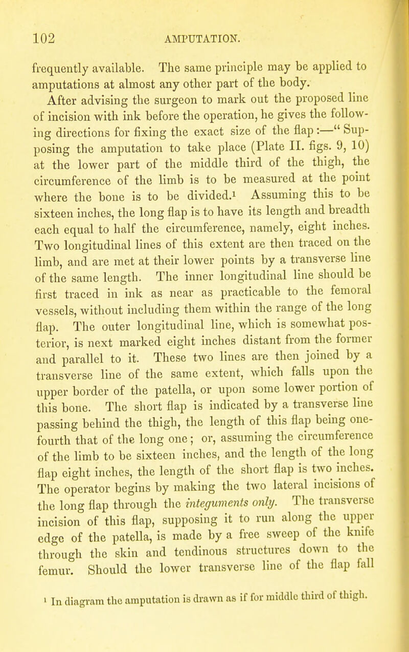frequently available. The same principle may be applied to amputations at almost any other part of the body. After advising the surgeon to mark out the proposed line of incision with ink before the operation, he gives the follow- ing directions for fixing the exact size of the flap:— Sup- posing the amputation to take place (Plate II. figs. 9, 10) at the lower part of the middle third of the thigh, the circumference of the limb is to be measured at the point where the bone is to be divided.* Assuming this to be sixteen inches, the long flap is to have its length and breadth each equal to half the circumference, namely, eight inches. Two longitudinal lines of this extent are then traced on the limb, and are met at their lower points by a transverse line of the same length. The inner longitudinal line should be first traced in ink as near as practicable to the femoral vessels, without including them within the range of the long flap. The outer longitudinal line, which is somewhat pos- terior, is next marked eight inches distant from the former and parallel to it. These two lines are then joined by a transverse line of the same extent, which falls upon the upper border of the patella, or upon some lower portion of this bone. The short flap is indicated by a transverse line passing behind the thigh, the length of this flap being one- fourth that of the long one; or, assuming tlie circumference of the limb to be sixteen inches, and the length of the long flap eight inches, the length of the short flap is two inches. The operator begins by making the two lateral incisions of the long flap through the integuments only. The transverse incision of this flap, supposing it to run along the upper edge of the patella, is made by a free sweep of the knife through the skin and tendinous structures down to the femur. Should the lower transverse line of the flap fall ' In diagram the amputation is drawn as if for middle third of thigh.