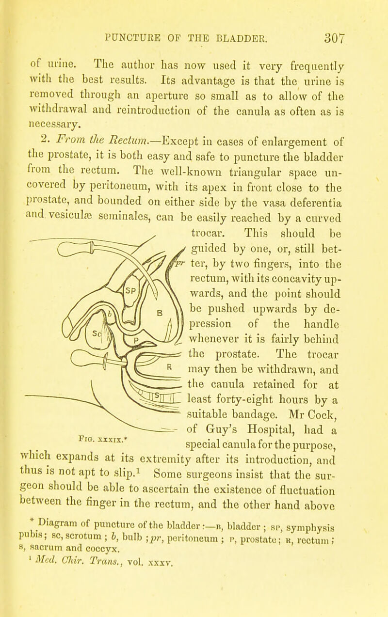 of urine. The author has now used it very frequently with the best results. Its advantage is that the urine is removed through an aperture so small as to allow of the withdrawal and reintroduction of the canula as often as is necessary. 2. From the Rectum.—Except in cases of enlargement of the prostate, it is both easy and safe to puncture the bladder from the rectum. The well-known triangular space un- covered by peritoneum, with its apex in front close to the prostate, and bounded on either side by the vasa deferentia and vesicular seminales, can be easily reached by a curved trocar. This should be guided by one, or, still bet- ter, by two fingers, into the rectum, with its concavity up- wards, and the point should be pushed upwards by de- pression of the handle whenever it is fairly behind the prostate. The trocar may then be withdrawn, and the canula retained for at least forty-eight hours by a suitable bandage. Mr Cock, of Guy's Hospital, had a special canula for the purpose, which expands at its extremity after its introduction, and thus is not apt to slip.1 Some surgeons insist that the sur- geon should be able to ascertain the existence of fluctuation between the finger in the rectum, and the other hand above * Diagram of puncture of the bladder.-—n, bladder ; sp, symphysis pub.s; sc,scrotum ; b, bulb ;pr, peritoneum ; r, prostate; k, rectum ; s, sacrum and coccyx. 1 Med. Cldr. Trans., vol. xxxv.