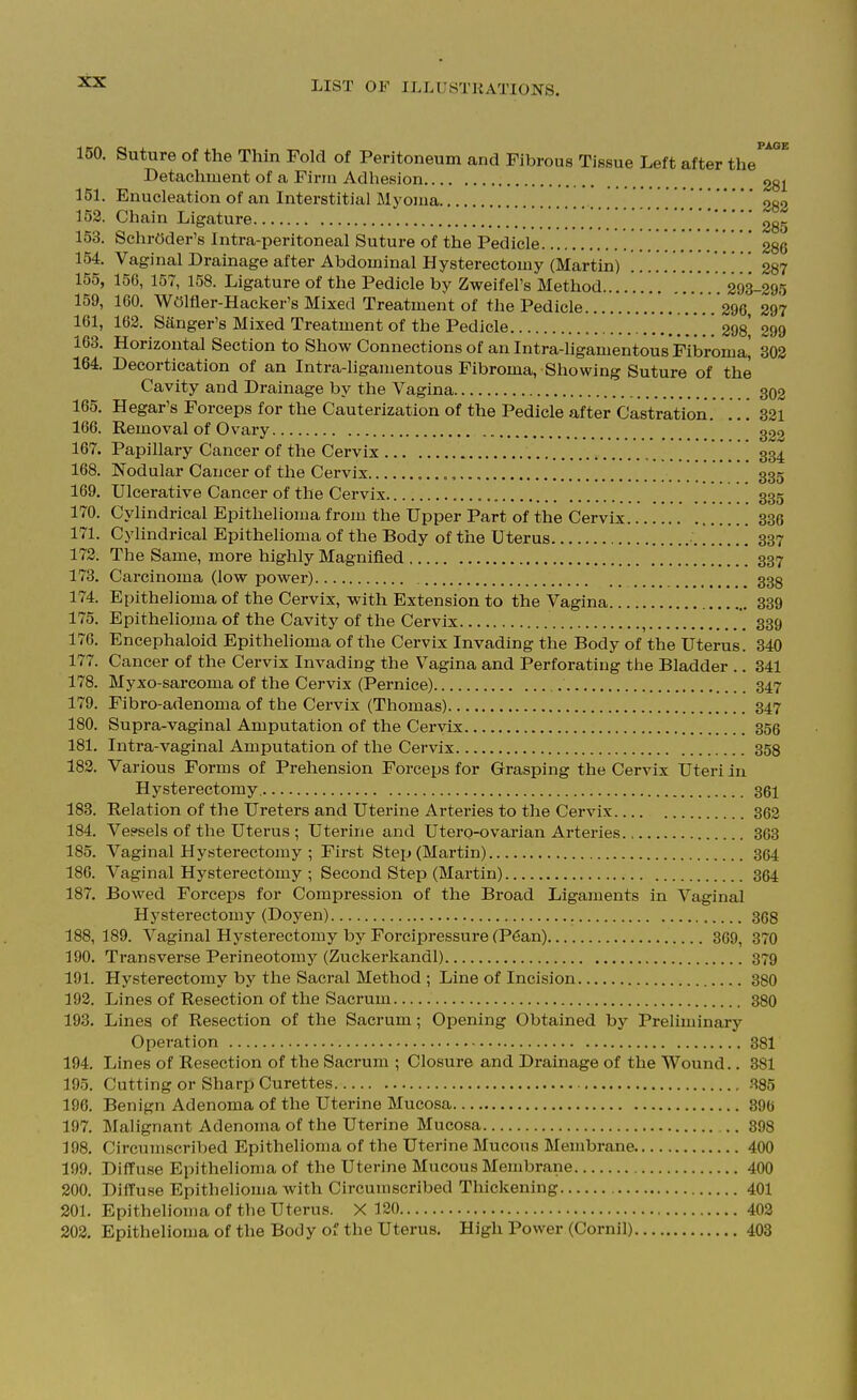 PAOE 150. Suture of the Thin Fold of Peritoneum and Fibrous Tissue Left after the Detachment of a Finn Adhesion 281 151. Enucleation of an Interstitial Myoma ,.282 152. Chain Ligature ggs 153. Schrf)der's Intra-peritoneal Suture of the Pedicle 286 154. Vaginal Drainage after Abdominal Hysterectomy (Martin) '. . . , . , 287 155. 15G, 157, 158. Ligature of the Pedicle by Zweifel's Method ...... 293-295 159, 160. WOlfler-Hacker's Mixed Treatment of the Pedicle '. . . . 296 297 161, 162. Sanger's Mixed Treatment of the Pedicle 298 299 163. Horizontal Section to Show Connections of an Intra-ligamentous Fibroma^ 302 164. Decortication of an Intra-ligamentous Fibroma, Showing Suture of the Cavity and Drainage by the Vagina 302 165. Hegar's Forceps for the Cauterization of the Pedicle after Castration. . . . 321 166. Removal of Ovary 322 167. Papillary Cancer of the Cervix 334 168. Nodular Cancer of the Cervix , 335 169. Ulcerative Cancer of the Cervix 335 170. Cylindrical Epithelioma from the Upper Part of the Cervix 336 171. Cylindrical Epithelioma of the Body of the U terus '..... [ 337 172. The Same, more highly Magnified 337 173. Carcinoma (low power) 33g 174. Epithelioma of the Cervix, with Extension to the Vagina 339 175. Epithelioma of the Cavity of the Cervix , 339 176. Encephaloid Epithelioma of the Cervix Invading the Body of the Uterus. 340 177. Cancer of the Cervix Invading the Vagina and Perforating tlie Bladder .. 341 178. Myxo-sarcoma of the Cervix (Pernice) 347 179. Fibro-adenoma of the Cervix (Thomas) 347 180. Supra-vaginal Amputation of the Cervix 356 181. Intra-vaginal Amputation of the Cervix 358 182. Various Forms of Prehension Forceps for Grasping the Cervix Uteri in Hysterectomy 361 183. Relation of the Ureters and Uterine Arteries to the Cervix 362 184. Ve?sels of the Uterus ; Uterine and Utero-ovarian Arteries 363 185. Vaginal Hysterectomy ; First Step (Martin) 364 186. Vaginal Hysterectomy ; Second Step (Martin) 364 187. Bowed Forceps for Compression of the Broad Ligaments in Vaginal Hysterectomy (Doyen) 368 188. 189. Vaginal Hysterectomy by Forcipressure (P6an) 369, 370 190. Transverse Perineotomj^ (Zuckerkandl) 379 191. Hysterectomy by the Sacral Method ; Line of Incision 380 192. Lines of Resection of the Sacrum 380 193. Lines of Resection of the Sacrum; Opening Obtained by Preliminary Operation 381 194. Lines of Resection of the Sacrum ; Closure and Drainage of the Wound.. 381 195. Cutting or Sharp Curettes .^85 196. Benign Adenoma of the Uterine Mucosa 89(j 197. Malignant Adenoma of the Uterine Mucosa .. 398 198. Circumscribed Epithelioma of the Uterine Mucous Membrane 400 199. Diffuse Epithelioma of the Uterine Mucous Membrane 400 200. Diffuse Epithelioma with Circumscribed Thickening 401 201. Epithelioma of the Uterus. X 120 402 202. Epithelioma of the Body of the Uterus. High Power (Cornil) 403