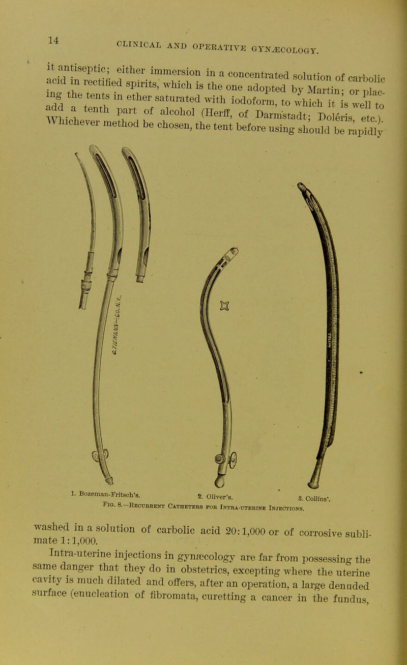 CLINICAL AND OPERATIVE GYNJ3C0L0GY. Wluchever method be chosen, the tent before using should bT:;piaiy 1. Bozeman-Fritsch's. 2. Oliver's. S. Collins'. Fig. 8.-EEOUBRKNT Catheters for Intra-uterink Injections. washed in a solution of carbolic acid 20:1,000 or of corrosive subli- mate 1:1,000. Intra-uterine injections in gynaecology are far from possessing the same danger that they do in obstetrics, excepting where the uterine cavity IS much dilated and offers, after an operation, a large denuded surface (enucleation of libromata, curetting a cancer in the fundus