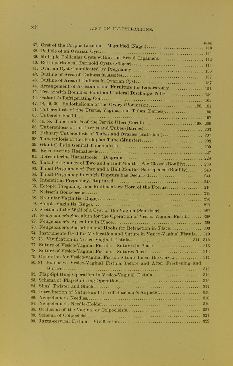 i 37. Cyst of the Corpus Luteum. Magnified (Nagel) Uo 38. Pedicle of an Ovarian Cyst [' 39. Multiple Follicular Cysts within the Broad Ligament \ \\% 40. Retro-peritoneal Dermoid Cysts (Sanger) ' \u 41. Ovarian Cyst Complicated by Pregnancy 13(J 42. Outline of Area of Dulness in Ascites \ \ . . ' m 43. Outline of Area of Dulness in Ovarian Cyst 137 44. Arrangement of Assistants and Furniture for Laparatomy ir>i 45. Trocar with Rounded Point and Lateral Discharge Tube .156 46. Galante's Refrigerating Coil ' 16<15 47. 48, 49, 50. Endothelioma of the Ovary (Pomorski) .180 181 51. Tuberculosis of the Uterus, Vagina, and Tubes (Barnes) ' 196 52. Tubercle Bacilli 197 53. 54, 55. Tuberculosis of the Cervix Uteri (Cornil) 198, 200 56. Tuberculosis of the Uterus and Tubes (Barnes) ] 203 57. Primary Tuberculosis of Tubes and Ovaries (Katschau) 207 58. Tuberculosis of the Fallopian Tube (Munster) 208 59. Giant Cells in Genital Tuberculosis 209 60. Retro-uterine Hematocele ' 227 61. Retro-uterine Hematocele. Diagram 229 62. Tubal Pregnancy of Two and a Half Months, Sac Closed (Bouilly). 239 63. Tubal Pregnancy of Two and a Half Months, Sac Opened (Bouilly) 240 64. Tubal Pregnancy in which Rupture has Occurred 241 65. Interstitial Pregnancy, Ruptured 243 66. Ectopic Pregnancy in a Rudimentary Horn of the Uterus 246 67. Neisser's Gonococcus 273 68. Granular Vaginitis (Ruge) 276 69. Simple Vaginitis (Ruge) 277 70. Section of the Wall of a Cyst of the Vagina (Schroder) 287 71. Neugebauer's Speculum for the Operation of Vesico-Vaginal Fistula 308 72. Neugebauer's Speculum in Place 308 73. Neugebauer's Speculum and Hooks for Retraction in Place 309 74. Instruments Used for Vivification and Suture in Vesico-Vaginal Fistula... 310 75. 76. Vivification in Vesico-Vaginal Fistula 311, 312 77. Suture of Vesico-Vaginal Fistula. Sutures in Place. 313 78. Suture of Vesico-Vaginal Fistula. Sutures Tied 313 79. Operation for Vesico-vaginal Fistula Situated near the Cervix 314 80. 81. Extensive Vesico-Vaginal Fistula, Before and After Freshening and Suture 315 82. Flap-Splitting Operation in Vesico-Vaginal Fistula 316 83. Schema of Flap-Splitting Operation 316 84. Sims' Twister and Shield 317 85. Introduction of Suture and Use of Bozeman's Adjuster 318 86. Neugebauer's Needles 318 87. Neugebauer's Needle-Holder 319 88. Occlusion of the Vagina, or Colpocleisis 321 89. Schema of Colpocleisis 321 90. Juxta-cervical Fistula. Vivification 322