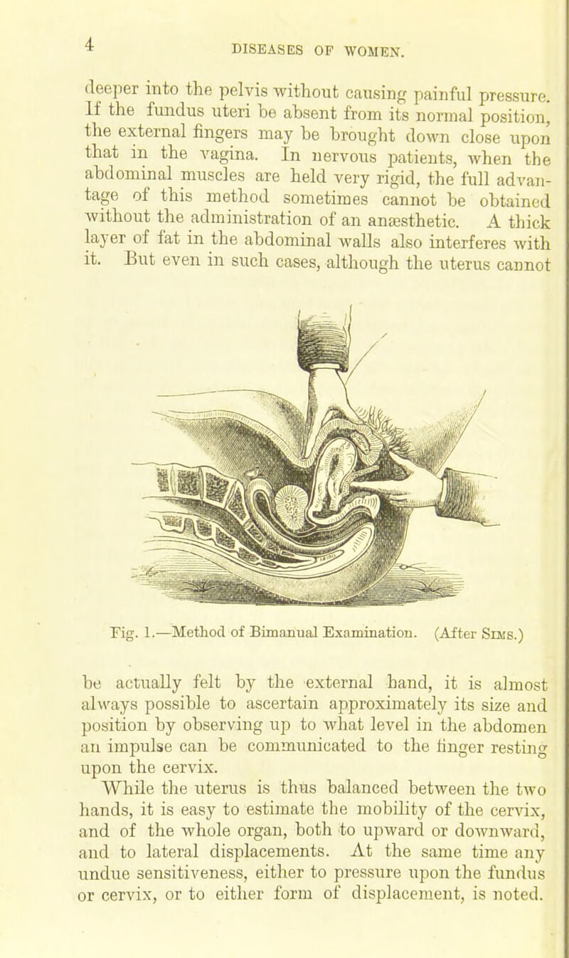 i deeper into the pelvis without causing painful pressure. If the fundus uteri be absent from its normal position) the external fingers may be brought down close upon that m the vagina. In nervous patients, when the abdominal muscles are held very rigid, the full advan- tage of this method sometimes cannot be obtained without the administration of an anaesthetic. A thick layer of fat in the abdominal walls also interferes with it. But even in such cases, although the uterus cannot Fig. 1.—Method of Bimanual Examination. (After Sims.) be actually felt by the external hand, it is almost always possible to ascertain approximately its size and position by observing up to what level in the abdomen an impulse can be communicated to the finger resting upon the cervix. While the uterus is thus balanced between the two hands, it is easy to estimate the mobility of the cervix, and of the whole organ, both to upward or downward, and to lateral displacements. At the same time any undue sensitiveness, either to pressure upon the fundus or cervix, or to either form of displacement, is noted.