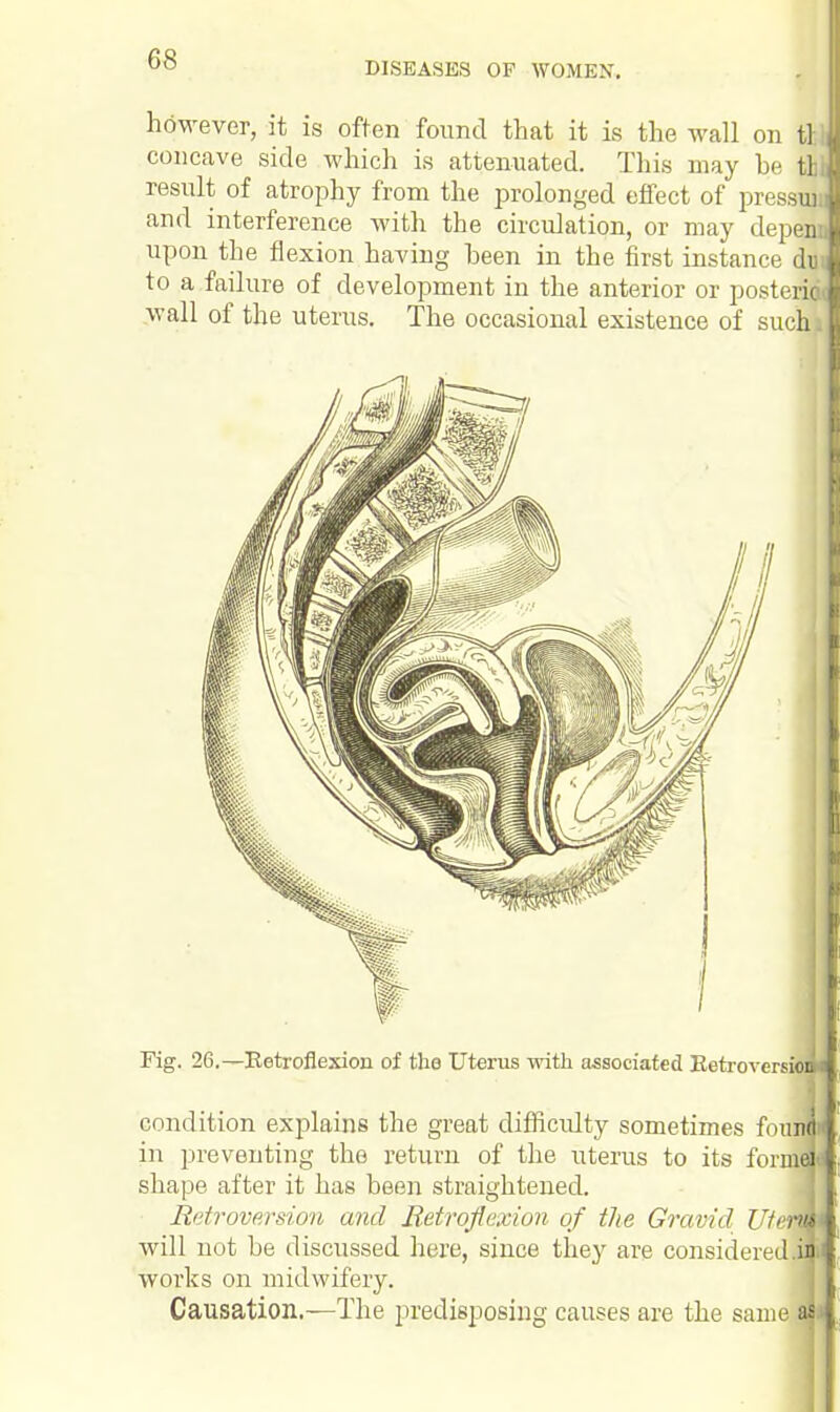 DISEASES OF WOMEN, however, it is often found that it is the wall on H concave side which is attenuated. This may be ti result of atrophy from the prolonged effect of pressuu and interference with the circulation, or may depea upon the flexion having been in the first instance dti to a failure of development in the anterior or posteri<j wall of the uterus. The occasional existence of such) Fig. 26.—Betroflexion of the Uterus with associated Eetroversi. condition explains the great difficrdty sometimes fou| in preventing the return of the uterus to its form? shape after it has been straightened. Retroversion and Betroflexion of the Gravid Ute will not be discussed here, since they are considered works on midwifery. Causation.—The predisposing causes are the same