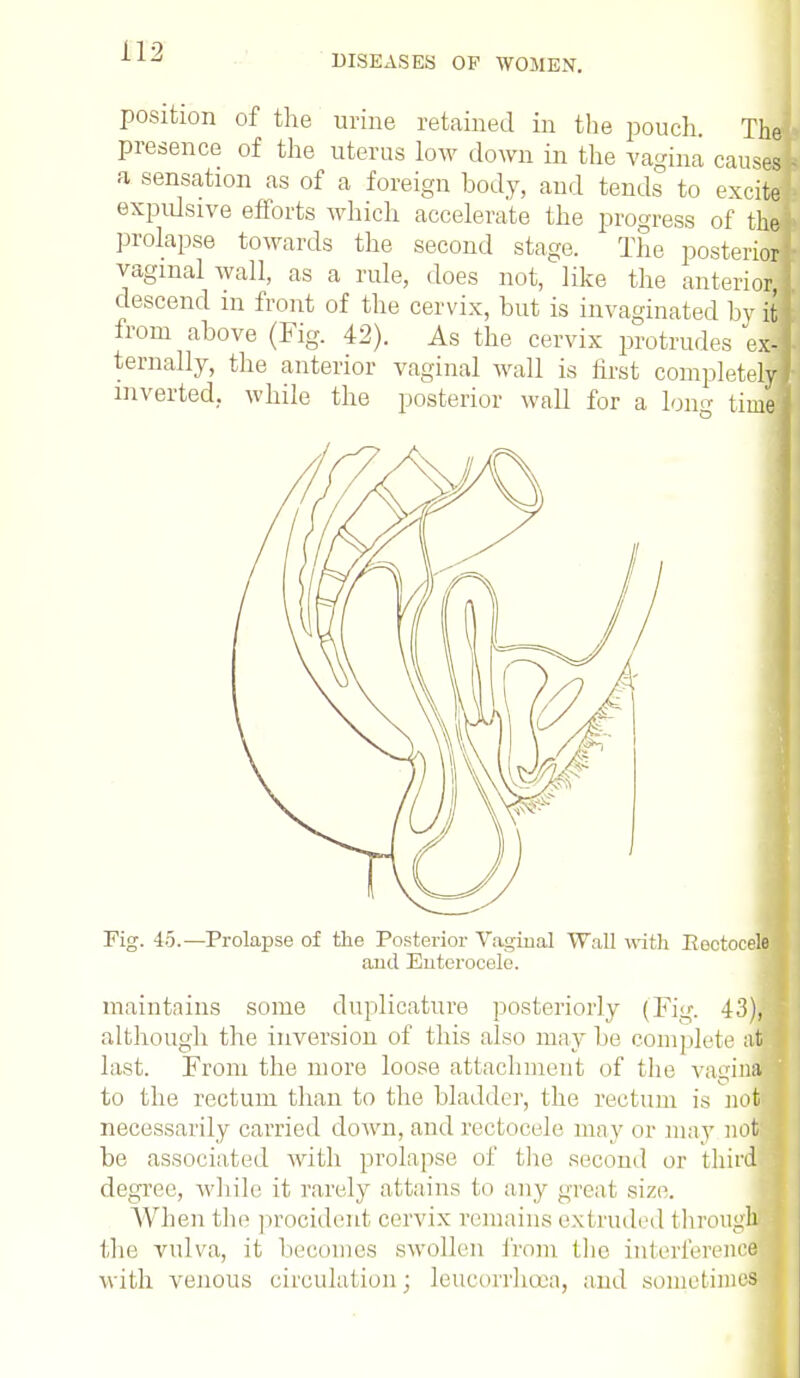 DISEASES OF WOMEN. position of the urine retained in the pouch. The presence of the uterus low down in the vagina causes a sensation as of a foreign body, and tends to excite expulsive efforts which accelerate the progress of the prolapse towards the second stage. The posterior vaginal wall, as a rule, does not, like the anterior, descend m front of the cervix, hut is invaginated by il from above (Fig. 42). As the cervix protrudes exj ternally, the anterior vaginal wall is first completer! inverted, while the posterior wall for a loner timel Fig. 45.—Prolapse of the Posterior Vaginal Wall with Eeotocele and Euterocele. maintains some duplicature posteriorly (Fig. 43) 1 although the inversion of this also maybe complete at last. From the more loose attachment of the vagina to the rectum than to the bladder, the rectum is now necessarily carried down, and rectocele may or mav not be associated with prolapse of the second or third degree, while it rarely attains to any great size. When the procident cervix remains extruded througj the vulva, it becomes swollen from the interference with venous circulation; leucorrhcea, and sometimes