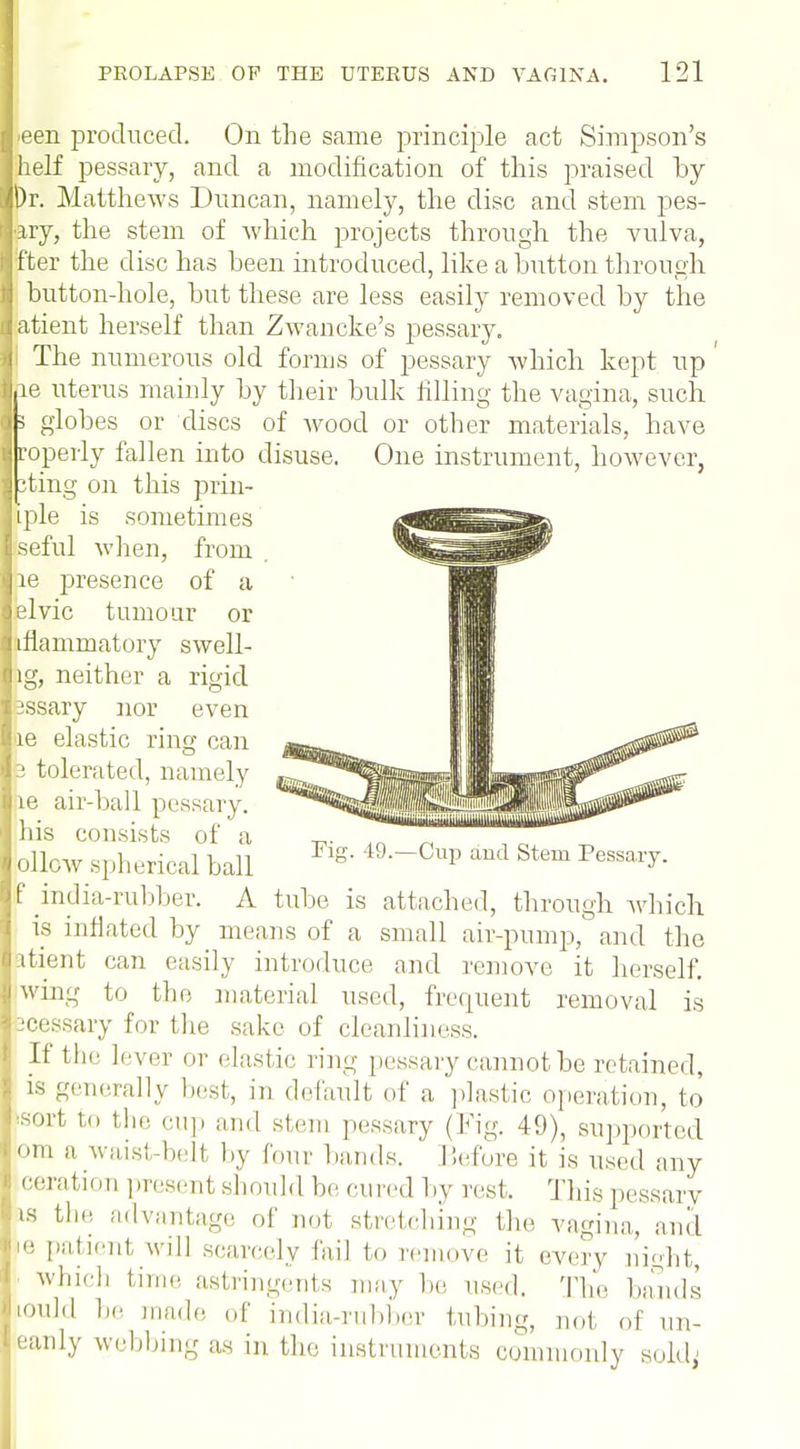 ■een produced. On the same principle act Simpson's helf pessary, and a modification of this praised by |)r. Matthews Duncan, namely, the disc and stem pes- ■ary, the stem of Avhich projects through the vulva, fter the disc has been introduced, like a button through button-hole, but these are less easily removed by the atient herself than Zwancke's pessary. The numerous old forms of pessary which kept up Lie uterus mainly by their bulk filling the vagina, such 3 globes or discs of wood or other materials, have roperly fallen into disuse. One instrument, however, pting on this prin- iple is sometimes seful when, from re presence of a jelvic tumour or I iflammatory swell- ig, neither a rigid ' 3ssary nor even he elastic ring can p tolerated, namely le air-ball pessary, his consists of a ollow spherical ball Cup and Stem Pessary. I india-rubber. A tube is attached, through which is inflated by means of a small air-pump, and the fetient can easily introduce and remove it herself, win-- to the material used, frequent removal 2C IS sessary for the sake of cleanliness. If the lever or elastic ring pessary cannot be retained, is generally best, in default of a plastic operation, to sort to the cup and stem pessary (Fig. 49), supported • •in a mist-belt by four bands. Before it is used any ceral ion present should be cured by rest. This pessary ts the advantage of not stretching the vagina, anil ie patient will scarcely fall to remove it every night, whir], time astringents may he used. The hands l°uld be made of india-rubber tubing, not of un- eanly webbing as in the instruments commonly sold,