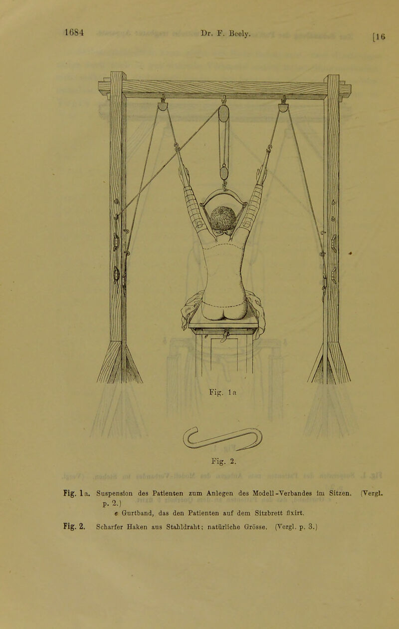 [16 Fig. 2. Fig. la. Suspension des Patienten zum Anlegen des Modell-Verbandes Im Sitzen. (Vergl. P. 2.) e Gurtband, das den Patienten auf dem Sitzbrett flxirt. Fig. 2. Scharfer Haken aus Stahldraht; natürliche Grösse. (Vergl. p. 3.)