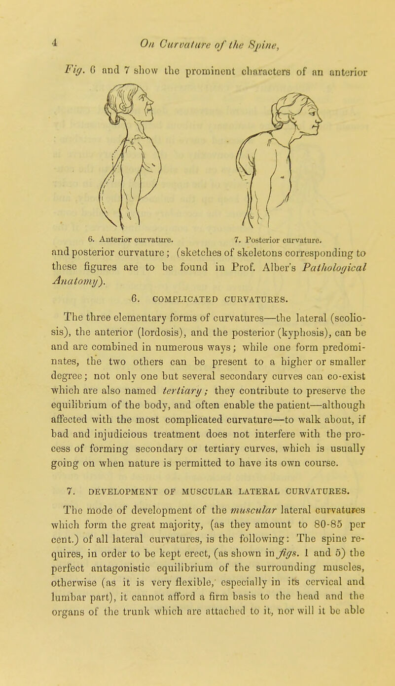 Fig. 6 and 7 sliow the prominent clinracters of an anterior 6. Anterior curvature. 7. Posterior curvature- and posterior curvature; (sketches of skeletons corresponding to these figures are to be found in Prof, Alber's Pathological Anatormj). 6. COMPLICATED CURVATURES. The three elementary forms of curvatures—the hateral (scolio- sis), the anterior (lordosis), and the posterior (kyphosis), can be and are combined in numerous ways; while one form predomi- nates, the two others can be present to a higher or smaller degree; not only one but several secondary curves can co-exist which are also named tertiary; they contribute to preserve the equilibrium of the body, and often enable the patient—although affected with the most complicated curvature—to walk about, if bad and injudicious treatment does not interfere with the pro- cess of forming secondary or tertiary curves, which is usually going on when nature is permitted to have its own course. 7. DEVELOPMENT OF MUSCULAR LATERAL CURVATURES. The mode of development of the muscular lateral curvatures which form the great majority, (as they amount to 80-85 per cent.) of all lateral curvatures, is the following: The spine re- quires, in order to be kept erect, (as shown in Jigs. 1 and 5) the perfect antagonistic equilibrium of the surrounding muscles, otherwise (as it is very flexible, especially in its cervical and lumbar part), it cannot afford a firm basis to the head and the organs of the trunk which are attached to it, nor will it be able