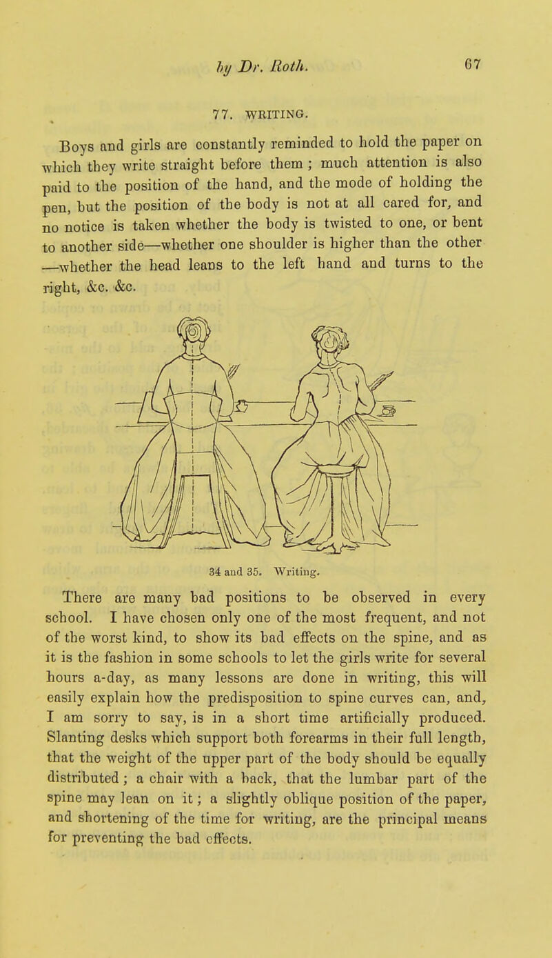 77. WRITING. Boys and girls are constantly reminded to hold the paper on -which they write straight before them ; much attention is also paid to the position of the hand, and the mode of holding the pen, but the position of the body is not at all cared for, and no notice is taken whether the body is twisted to one, or bent to another side—whether one shoulder is higher than the other whether the head leans to the left hand and turns to the right, &c. &c. 34 and 35. Writing. There are many bad positions to be observed in every school. I have chosen only one of the most frequent, and not of the worst kind, to show its bad effects on the spine, and as it is the fashion in some schools to let the girls write for several hours a-day, as many lessons are done in writing, this will easily explain how the predisposition to spine curves can, and, I am sorry to say, is in a short time artificially produced. Slanting desks which support both forearms in their full length, that the weight of the upper part of the body should be equally distributed; a chair with a back, that the lumbar part of the spine may lean on it; a slightly oblique position of the paper, and shortening of the time for writing, are the principal means for preventing the bad effects.