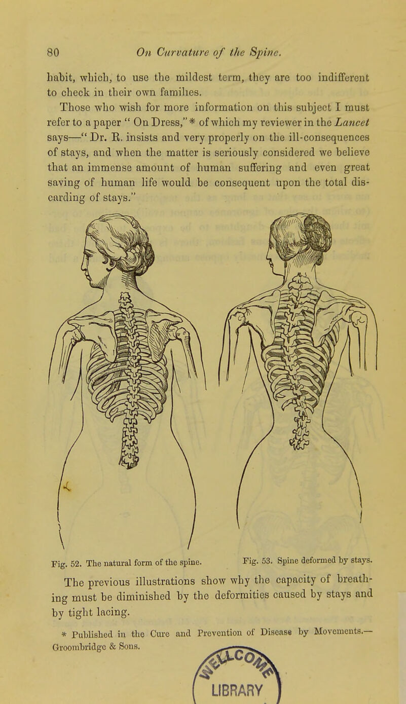 habit, wliicli, to use the mildest term, they are too indifferent to check in their own faraihes. Those who wish for more information on this subject I must refer to a paper  On Dress,* of which my reviewer in the Lancet says— Dr. B. insists and very properly on the ill-consequences of stays, and when the matter is seriously considered we believe that an immense amount of human suffering and even great saving of human life would be consequent upon the total dis- carding of stays. Fig. 52. The natural form of the spine. Fig. 53. Spine aeformed by stays. The previous illustrations show why the capacity of breath- ing must be diminished by the deformities caused by stays and by tight lacing. * PubUshed in the Cure and Prevention of Diseass by Movements.— Groombridgc & Sons. ^-nr^TJT'v^