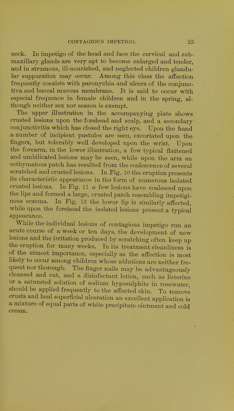 neck. In impetigo of the head and face the cervical and sub- maxillary glands are very apt to become enlarged and tender, and in strumous, ill-nourished, and neglected children glandu- lar suppuration may occur. Among this class the affection frequently coexists with paronychia and ulcers of the conjunc- tiva and buccal mucous membrane. It is said to occur with especial frequence in female children and in the spring, al- though neither sex nor season is exempt. The upper illustration in the accompanying plate shows crusted lesions upon the forehead and scalp, and a secondary conjunctivitis which has closed the right eye. Upon the hand a number of incipient pustules are seen, excoriated upon the fingers, but tolerably well developed upon the wrist. Upon the forearm, in the lower illustration, a few typical flattened and umbilicated lesions may be seen, while upon the arm an ecthymatous patch has resulted from the coalescence of several scratched and crusted lesions. In Fig. 10 the eruption presents its characteristic appearance in the form of numerous isolated crusted lesions. In Fig. 11 a few lesions have coalesced upon the lips and formed a large, crusted patch resembling impetigi- nous eczema. In Fig. 12 the lower lip is similarly affected, while upon the forehead the isolated lesions present a typical appearance. While the individual lesions of contagious impetigo run an acute course of a week or ten days, the development of new lesions and the irritation produced by scratching often keep up the eruption for many weeks. In its treatment cleanliness is of the utmost importance, especially as the affection is most likely to occur among children whose ablutions are neither fre- quent nor thorough. The finger nails may be advantageously cleansed and cut, and a disinfectant lotion, such as listerine or a saturated solution of sodium hyposulphite in rosewater, should be applied frequently to the affected skin. To remove crusts and heal superficial ulceration an excellent application is a mixture of equal parts of white precipitate ointment and cold cream.