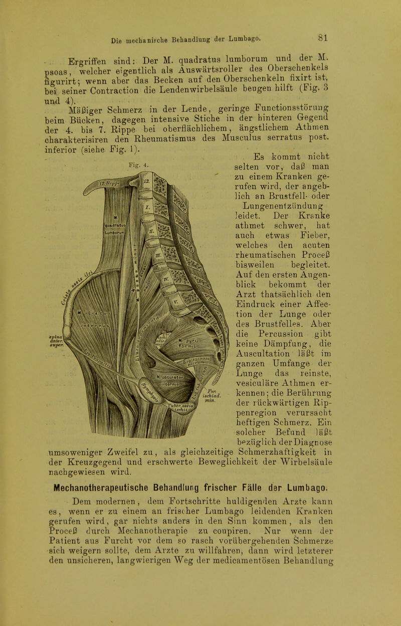 Fiff. 4. Ergriffen sind: Der M. quadratus lumborum und der M. psoas, welcher eigentlich als AuswärtsroUer des Oberschenkels figurirt; wenn aber das Becken auf den Oberschenkeln fixirt ist, bei seiner Contraction die Lendenwirbelsäule beugen hilft (Fig. 3 uu-d 4). -n • Mäßiger Schmerz in der Lende, geringe Functionsstoruug beim Bücken, dagegen intensive Stiche in der hinteren Gegend der 4. bis 7. Rippe bei oberflächlichem, ängstlichem Athmen charakterisiren den Rheumatismus des Musculus serratus post. inferior (siehe Fig. 1). Es kommt nicht selten vor, daß man zu einem Kranken ge- rufen wird, der angeb- lich an Brustfell- oder Lungenentzündung leidet. Der Kranke athmet schwer, hat auch etwas Fieber, welches den acuten rheumatischen Proceß bisweilen begleitet. Auf den ersten Augen- blick bekommt der Arzt thatsächlich den Eindruck einer AfFec- tion der Lunge oder des Brustfelles. Aber die Percussion gibt keine Dämpfung, die Auscultation läßt im ganzen Umfange der Lunge das reinste, vesiculäre Athmen er- kennen ; die Berührung der rückwärtigen Rip- penregion verursacht heftigen Schmerz. Ein solcher Befand läßt bezüglich der Diagnose umsoweniger Zweifel zu, als gleichzeitige Schmerzhaftigkeit in der Kreuzgegend und erschwerte Beweglichkeit der Wirbelsäule nachgewiesen wird. Mechanoiherapeutische Behandlung frischer Fälle der Lumbago. Dem modernen, dem Fortschritte huldigenden Arzte kann es, wenn er zu einem an frischer Lumbago leidenden Kranken gerufen wird, gar nichts anders in den Sinn kommen, als den Proceß durch Mechanotherapie zu coupiren. Nur wenn der Patient aus Furcht vor dem so rasch vorübergehenden Schmerze sich weigern sollte, dem Arzte zu willfahren, dann wird letzterer den unsicheren, langwierigen Weg der medicamentösen Behandlung