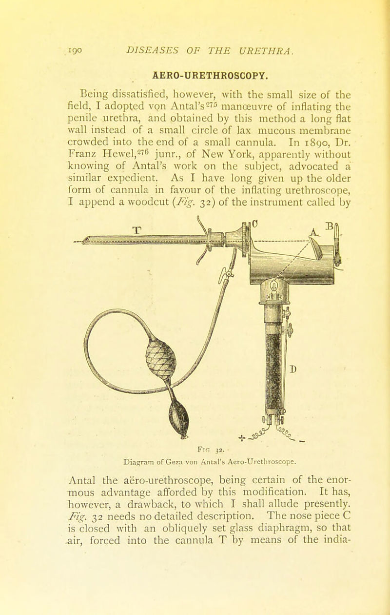 AERO-URETHROSCOPY. Being dissatisfied, however, with the small size of the field, I adopted von Antal's275 manoeuvre of inflating the penile urethra, and obtained by this method a long fiat wall instead of a small circle of lax mucous membrane crowded into the end of a small cannula. In 1890, Dr. Franz Hewel,276 junr., of New York, apparently without knowing of Antal's work on the subject, advocated a similar expedient. As I have long given up the older form of cannula in favour of the inflating urethroscope, I append a woodcut (Fig. 32) of the instrument called by Fin 32. Diagram of Geza von Antal's Aero-Urethroscope. Antal the aero-urethroscope, being certain of the enor- mous advantage afforded by this modification. It has, however, a drawback, to which I shall allude presently. Fig. 32 needs no detailed description. The nose piece C is closed with an obliquely set glass diaphragm, so that air, forced into the cannula T by means of the india-