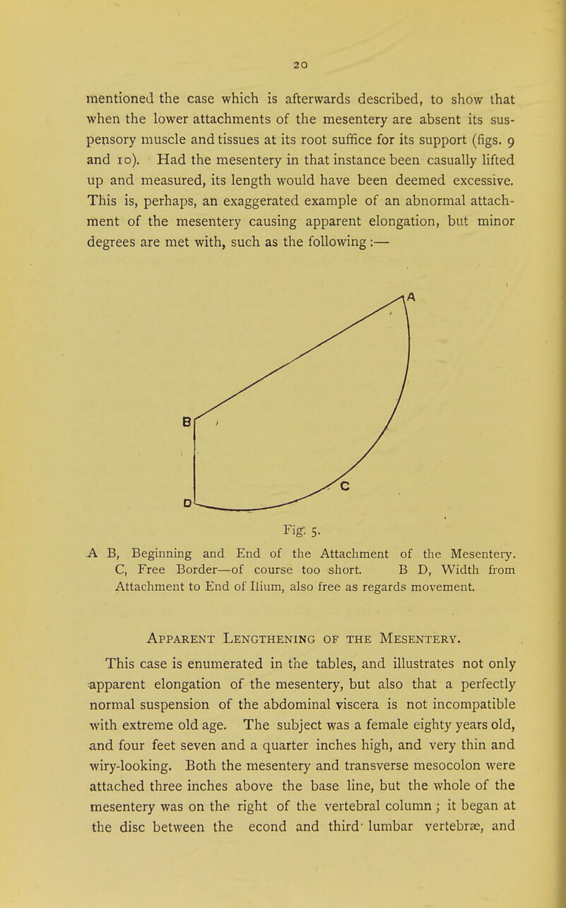 mentioned the case which is afterwards described, to show that when the lower attachments of the mesentery are absent its sus- pensory muscle and tissues at its root sufifice for its support (figs. 9 and 10). Had the mesentery in that instance been casually lifted up and measured, its length would have been deemed excessive. This is, perhaps, an exaggerated example of an abnormal attach- ment of the mesentery causing apparent elongation, but minor degrees are met with, such as the following:— .A B, Beginning and End of the Attachment of the Mesentery. C, Free Border—of course too short. B D, Width from Attachment to End of Ilium, also free as regards movement. Apparent Lengthening of the Mesentery. This case is enumerated in the tables, and illustrates not only apparent elongation of the mesentery, but also that a perfectly normal suspension of the abdominal viscera is not incompatible with extreme old age. The subject was a female eighty years old, and four feet seven and a quarter inches high, and very thin and wiry-looking. Both the mesentery and transverse mesocolon were attached three inches above the base line, but the whole of the mesentery was on the right of the vertebral column ; it began at the disc between the econd and third' lumbar vertebrze, and