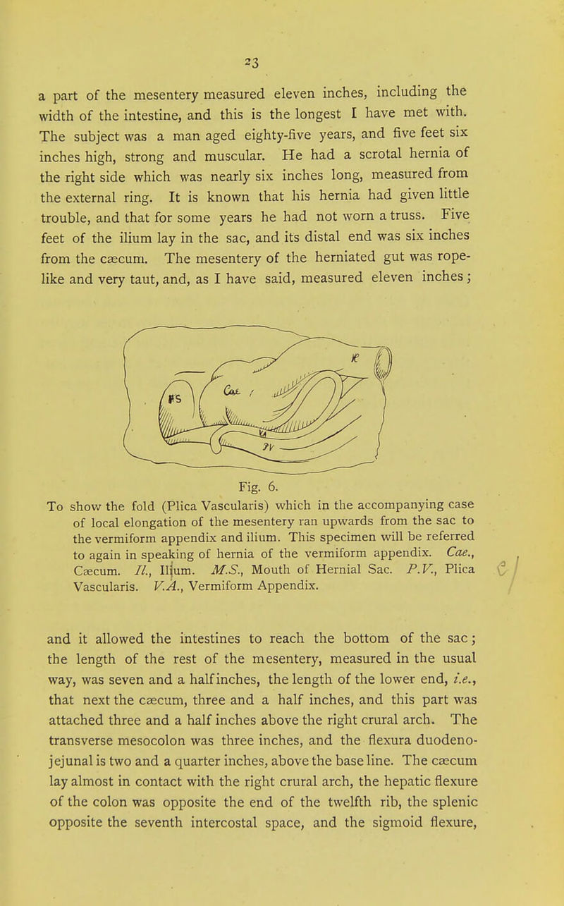 a part of the mesentery measured eleven inches, including the width of the intestine, and this is the longest I have met with. The subject was a man aged eighty-five years, and five feet six inches high, strong and muscular. He had a scrotal hernia of the right side which was nearly six inches long, measured from the external ring. It is known that his hernia had given little trouble, and that for some years he had not worn a truss. Five feet of the ilium lay in the sac, and its distal end was six inches from the caecum. The mesentery of the herniated gut was rope- like and very taut, and, as I have said, measured eleven inches; Fig. 6. To shov/ the fold (Plica Vascularis) which in the accompanying case of local elongation of the mesentery ran upwards from the sac to the vermiform appendix and ilium. This specimen will be referred to again in speaking of hernia of the vermiform appendix. Cae., Caecum. //., Ilpm. M.S., Mouth of Hernial Sac. P.V., Plica Vascularis. V.A., Vermiform Appendix. and it allowed the intestines to reach the bottom of the sac; the length of the rest of the mesentery, measured in the usual way, was seven and a half inches, the length of the lower end, /.<?., that next the caecum, three and a half inches, and this part was attached three and a half inches above the right crural arch. The transverse mesocolon was three inches, and the flexura duodeno- jejunal is two and a quarter inches, above the base line. The caecum lay almost in contact with the right crural arch, the hepatic flexure of the colon was opposite the end of the twelfth rib, the splenic opposite the seventh intercostal space, and the sigmoid flexure,