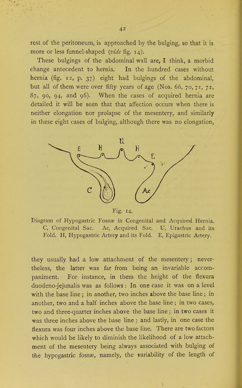 rest of the peritoneum, is approached by the bulging, so that it is more or less funnel-shaped {TDide fig. 14). These bulgings of the abdominal wall are, I think, a morbid change antecedent to hernia. In the hundred cases without hernia (fig. 12, p. 37) eight had bulgings of the abdominal, but all of them were over fifty years of age (Nos. 66, 70, 71, 72, 87, 90, 94, and 96). When the cases of acquired hernia are detailed it will be seen that that affection occurs when there is neither elongation nor prolapse of the mesentery, and similarly in these eight cases of bulging, although there was no elongation, Fig. 14. Diagram of Hypogastric Fossae in Congenital and Acquired Hernia. C, Congenital Sac. Ac, Acquired Sac. U, Urachus and its Fold. H, Hypogastric Artery and its Fold. E, Epigastric Artery. they usually had a low attachment of the mesentery; never- theless, the latter was far from being an invariable accom- paniment. For instance, in them the height of the flexura duodeno-jejunalis was as follows : In one case it was on a level with the base line; in another, two inches above the base line; in another, two and a half inches above the base hne; in two cases, two and three-quarter inches above the base line; in two cases it was three inches above the base line ; and lastly, in one case the flexura was four inches above the base line. There are two factors which would be likely to diminish the likelihood of a low attach- ment of the mesentery being always associated with bulging of the hypogastric fossae, namely, the variability of the length of