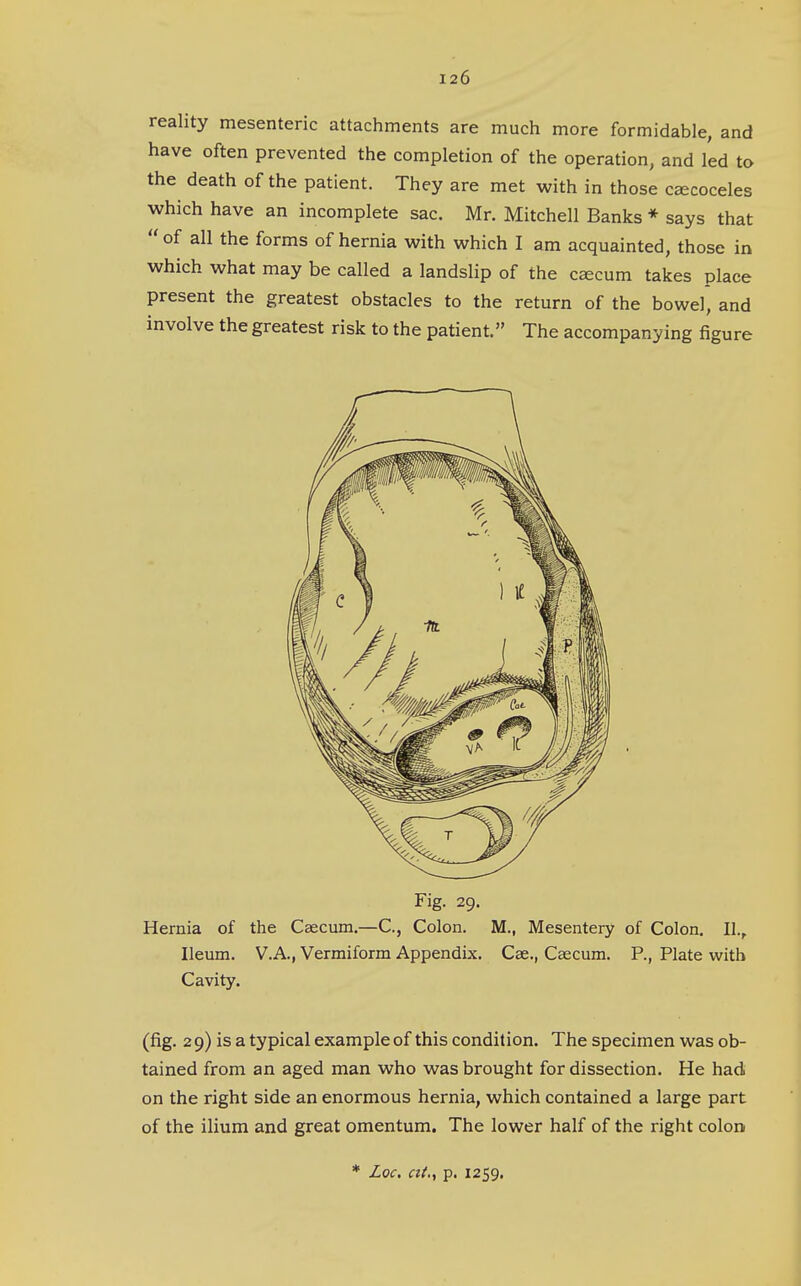 reality mesenteric attachments are much more formidable, and have often prevented the completion of the operation, and led to the death of the patient. They are met with in those c^coceles which have an incomplete sac. Mr. Mitchell Banks * says that  of all the forms of hernia with which I am acquainted, those in which what may be called a landslip of the ceecum takes place present the greatest obstacles to the return of the bowel, and involve the greatest risk to the patient. The accompanying figure Fig. 29. Hernia of the Caecum.—C, Colon. M., Mesentery of Colon. II., Ileum. V.A., Vermiform Appendix. Cse., Caecum. P., Plate with Cavity. (fig. 2 9) is a typical example of this condition. The specimen was ob- tained from an aged man who was brought for dissection. He had on the right side an enormous hernia, which contained a large part of the ilium and great omentum. The lower half of the right colon * Loc, at.i p. 1259.