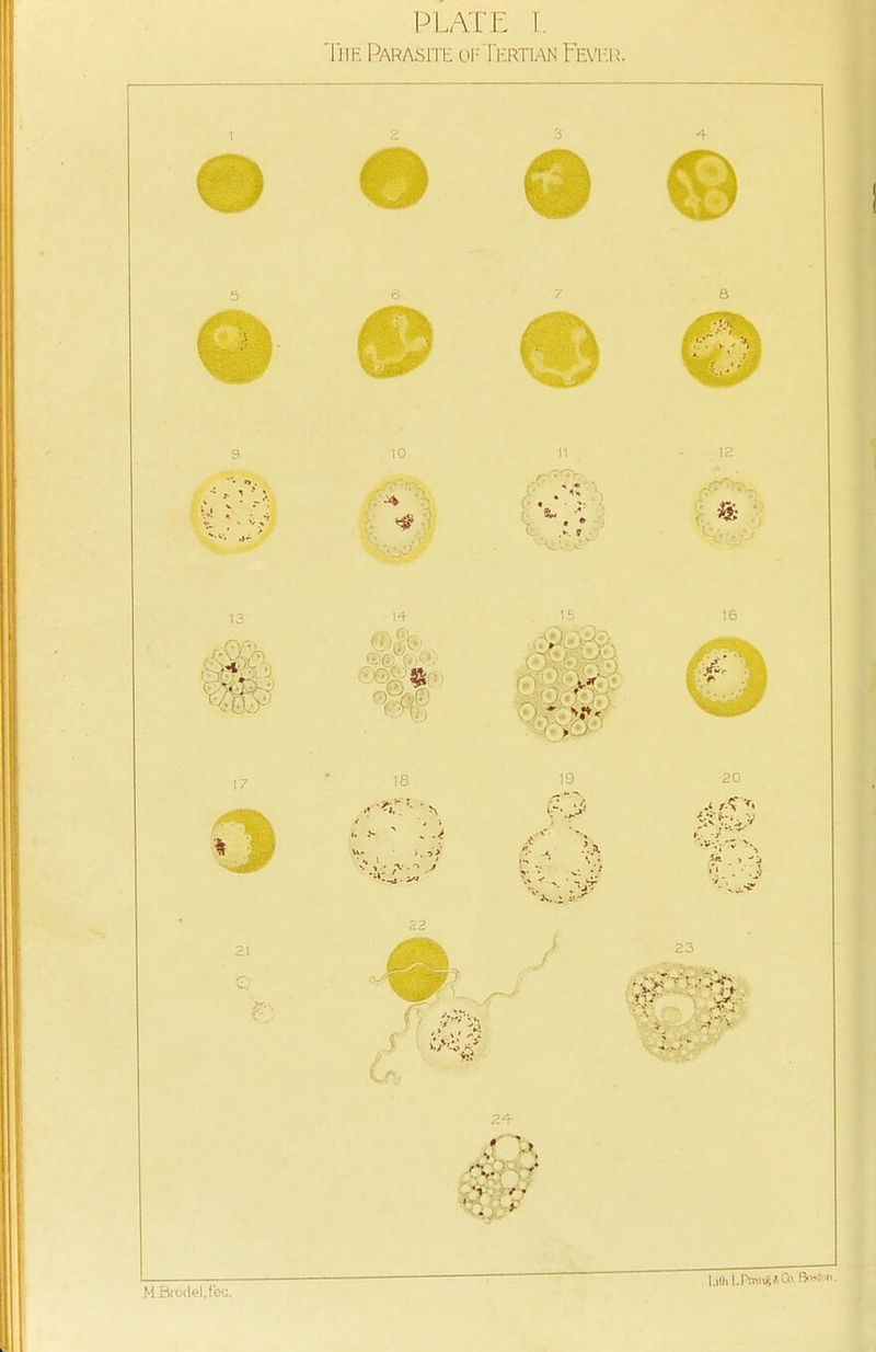 PLATE [. The Parasite of Tertian Fever. 3 4 18 19 20 M Brddel,fec, I.ith LPmng*Oo- Boston
